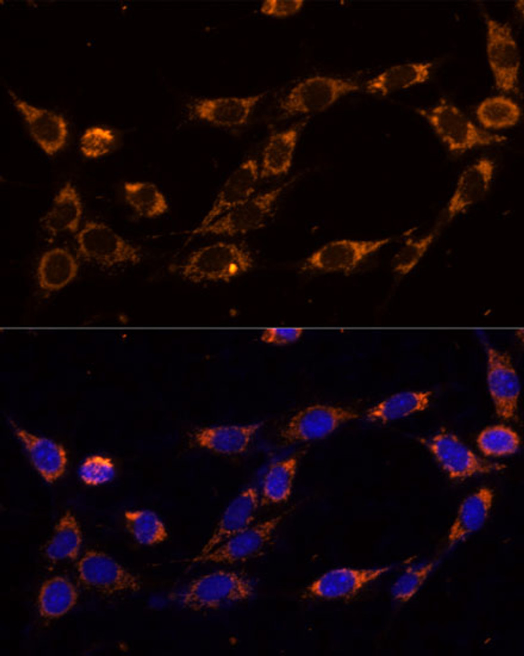 Immunofluorescence analysis of NIH-3T3 cells using TRAP1 Polyclonal Antibody (19-355) at dilution of 1:100 (40x lens) . Blue: DAPI for nuclear staining.