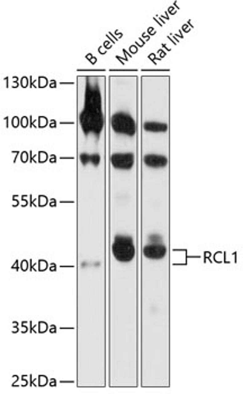 Western blot analysis of extracts of various cell lines, using RCL1 antibody (19-357) at 1:1000 dilution.<br/>Secondary antibody: HRP Goat Anti-Rabbit IgG (H+L) at 1:10000 dilution.<br/>Lysates/proteins: 25ug per lane.<br/>Blocking buffer: 3% nonfat dry milk in TBST.<br/>Detection: ECL Basic Kit.<br/>Exposure time: 10s.