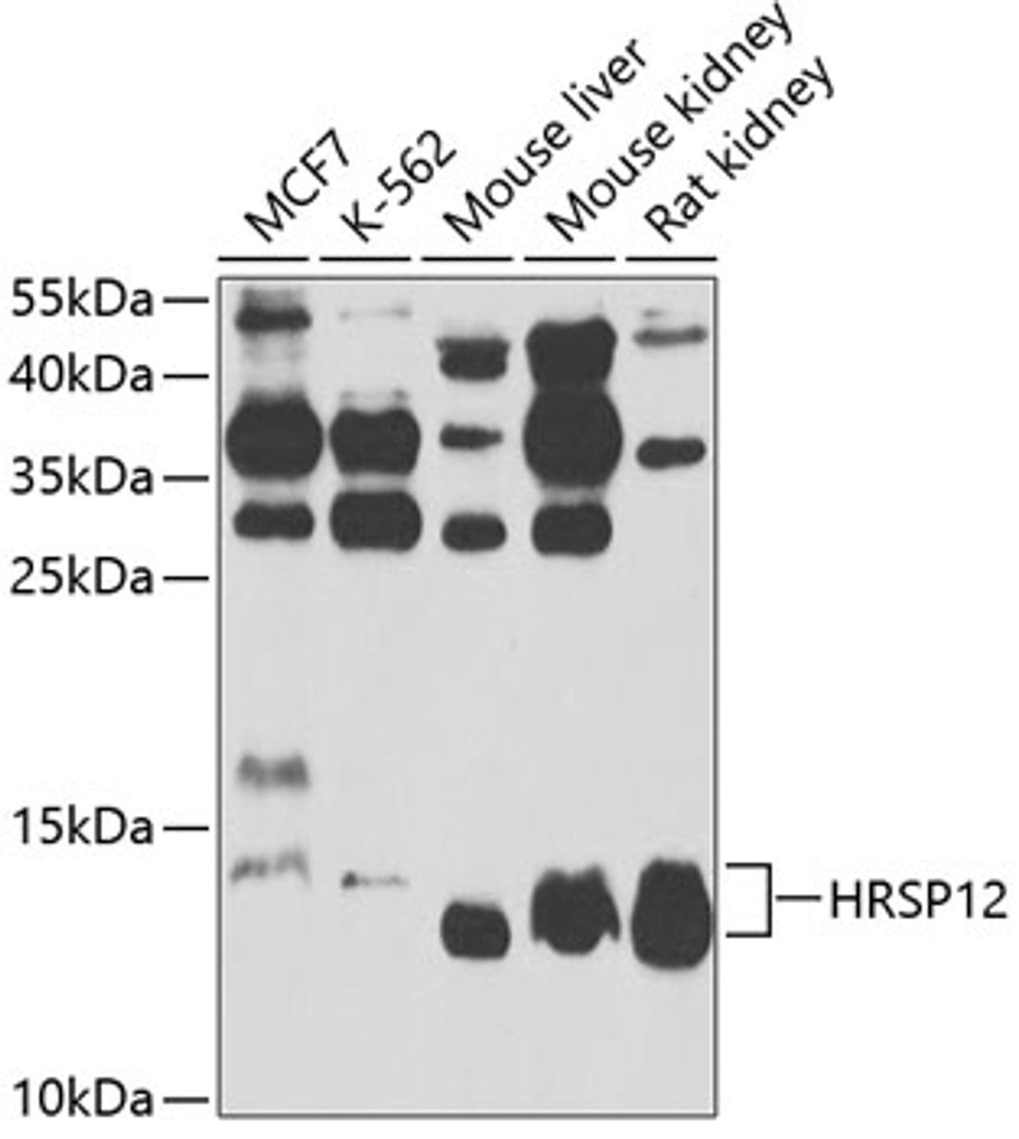 Western blot analysis of extracts of various cell lines, using HRSP12 antibody (19-358) at 1:1000 dilution.<br/>Secondary antibody: HRP Goat Anti-Rabbit IgG (H+L) at 1:10000 dilution.<br/>Lysates/proteins: 25ug per lane.<br/>Blocking buffer: 3% nonfat dry milk in TBST.<br/>Detection: ECL Basic Kit.<br/>Exposure time: 90s.