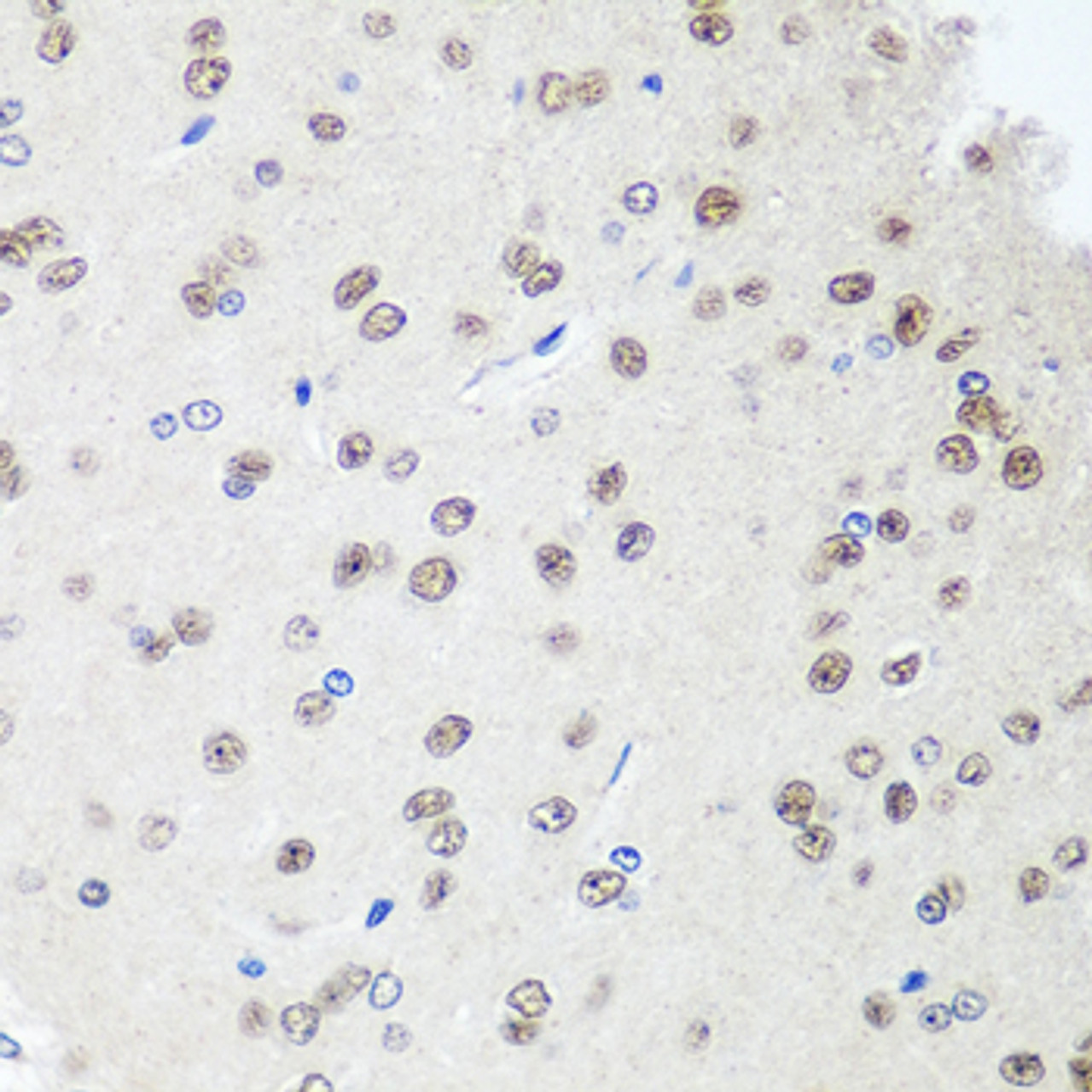 Immunohistochemistry of paraffin-embedded rat brain using SAP18 antibody (19-359) at dilution of 1:100 (40x lens) .