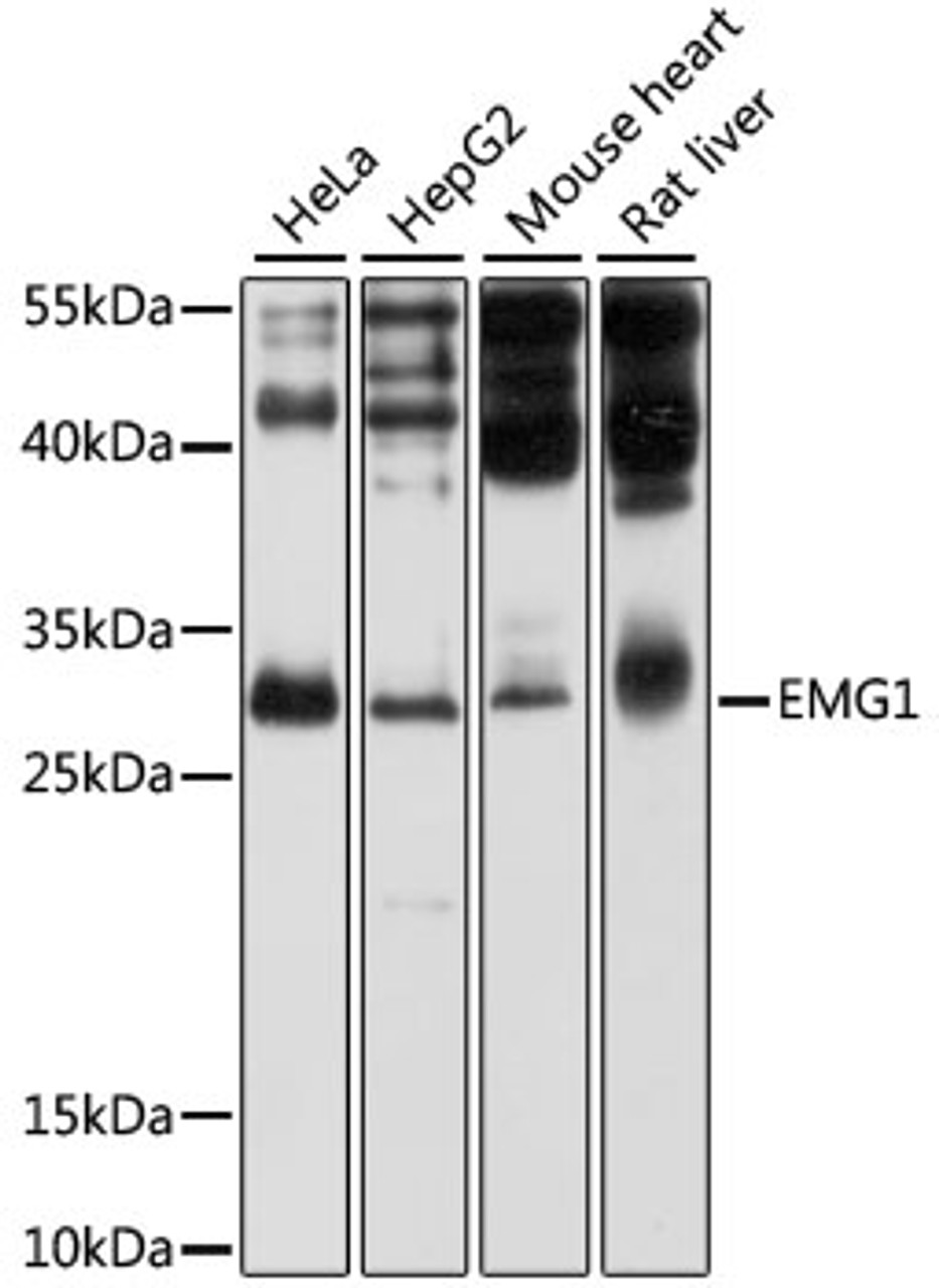 Western blot analysis of extracts of various cell lines, using EMG1 antibody (19-364) at 1:1000 dilution.<br/>Secondary antibody: HRP Goat Anti-Rabbit IgG (H+L) at 1:10000 dilution.<br/>Lysates/proteins: 25ug per lane.<br/>Blocking buffer: 3% nonfat dry milk in TBST.<br/>Detection: ECL Basic Kit.<br/>Exposure time: 1s.
