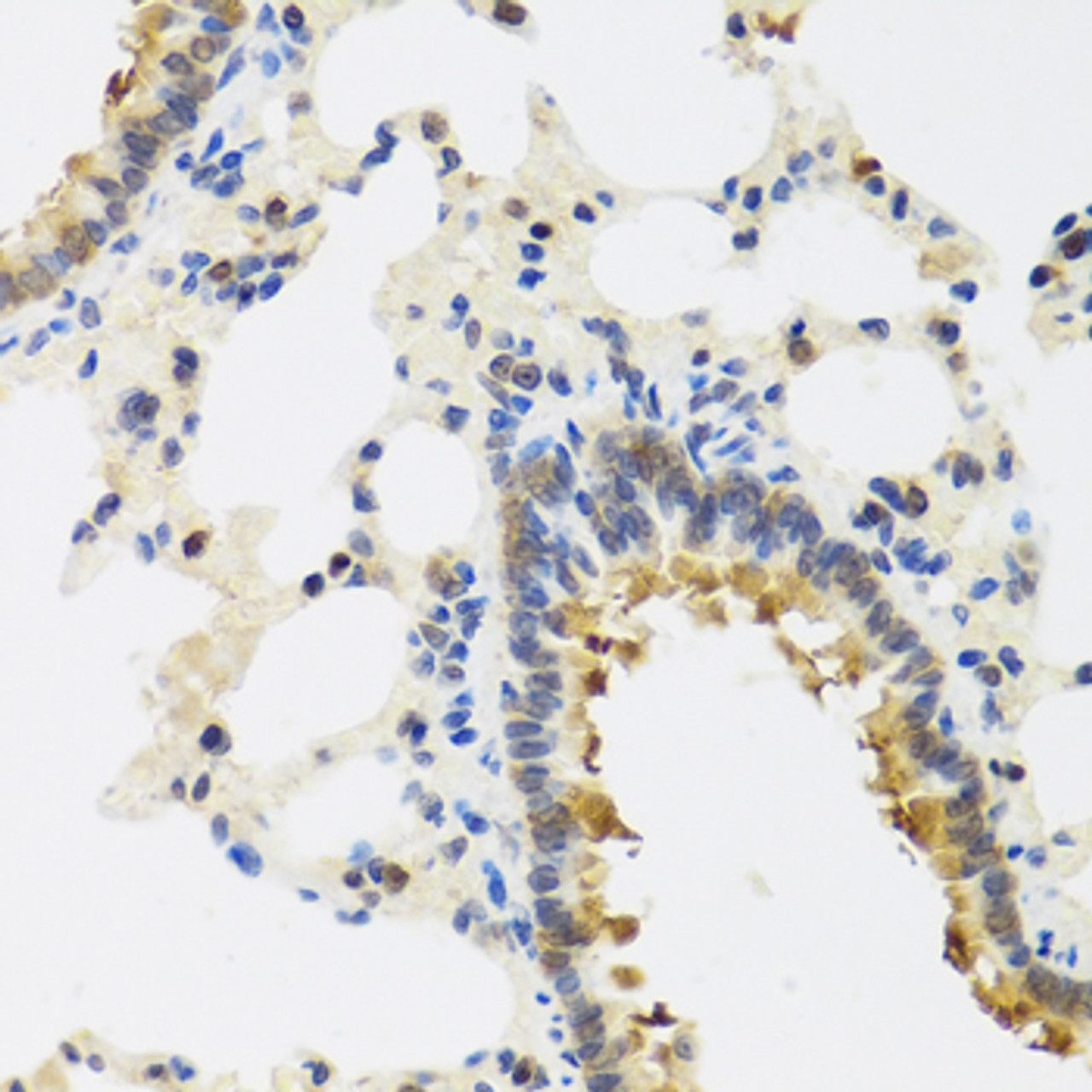 Immunohistochemistry of paraffin-embedded rat lung using CRTAP antibody (19-366) at dilution of 1:100 (40x lens) .