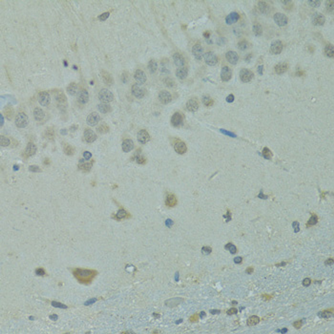 Immunohistochemistry of paraffin-embedded rat brain using IVNS1ABP antibody (19-371) at dilution of 1:100 (40x lens) .
