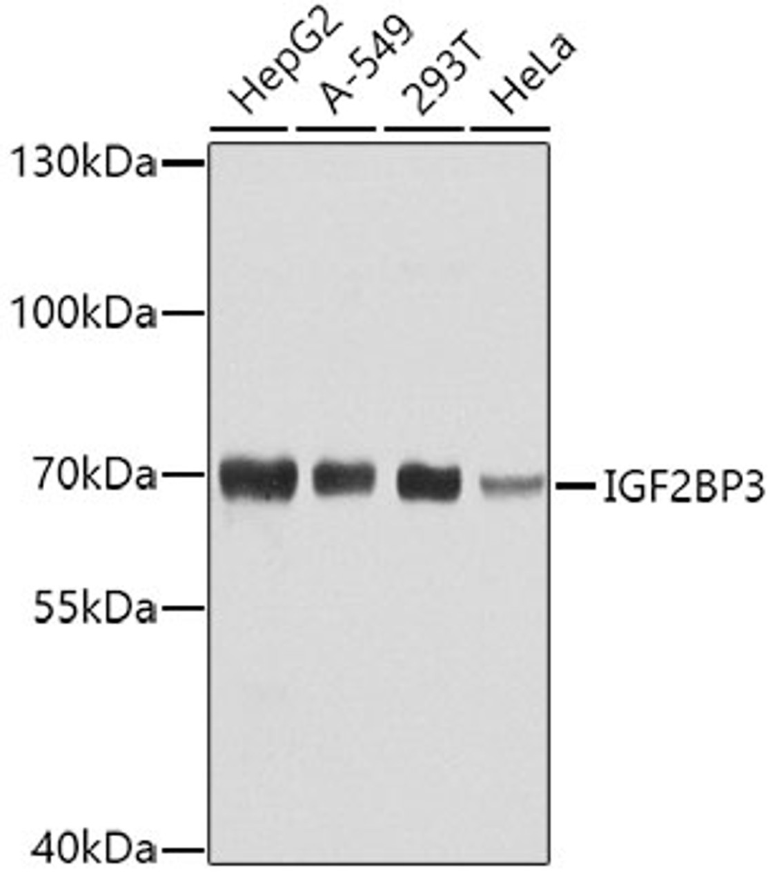 Western blot analysis of extracts of various cell lines, using IGF2BP3 antibody (19-372) at 1:1000 dilution.<br/>Secondary antibody: HRP Goat Anti-Rabbit IgG (H+L) at 1:10000 dilution.<br/>Lysates/proteins: 25ug per lane.<br/>Blocking buffer: 3% nonfat dry milk in TBST.<br/>Detection: ECL Basic Kit.<br/>Exposure time: 15s.