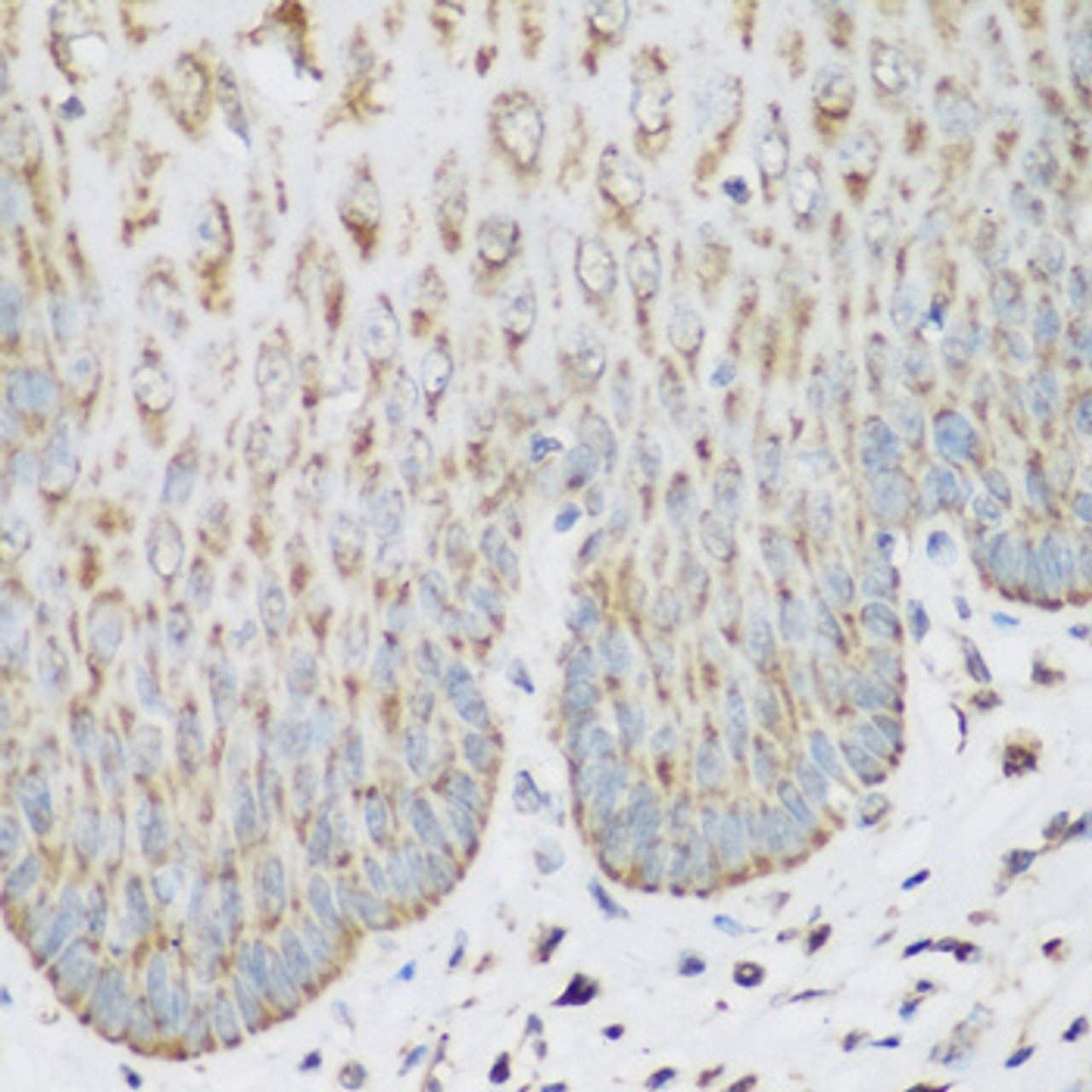 Immunohistochemistry of paraffin-embedded human esophagus using IGF2BP3 antibody (19-372) at dilution of 1:200 (40x lens) .