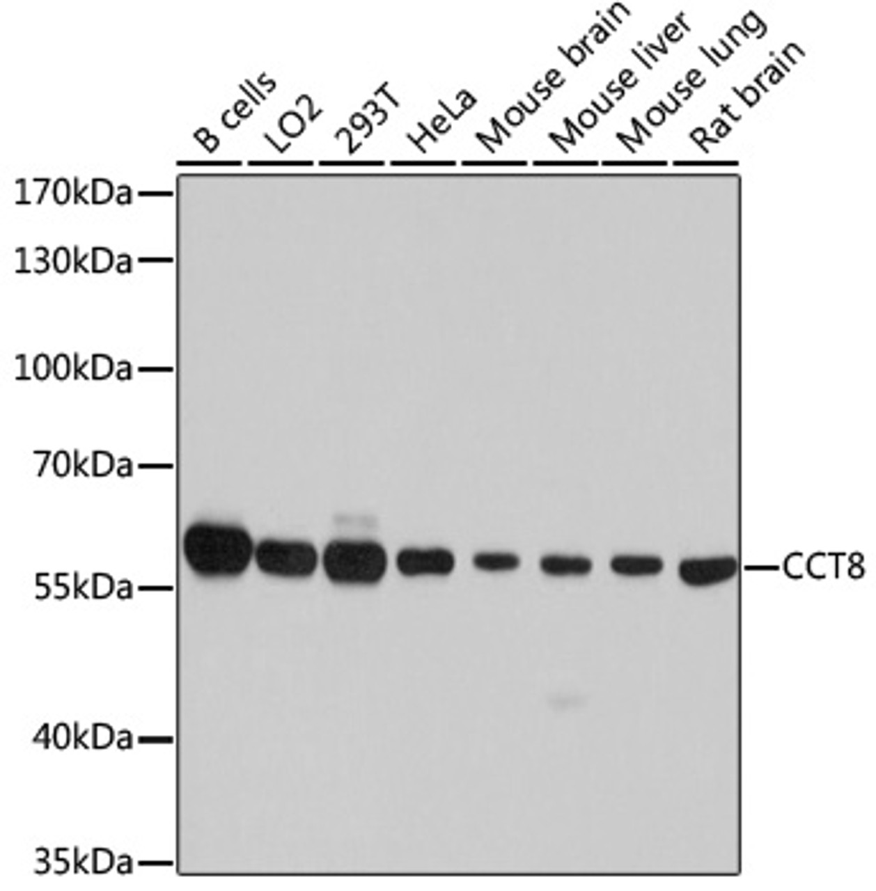 Western blot analysis of extracts of various cell lines, using CCT8 antibody (19-376) at 1:7000 dilution.<br/>Secondary antibody: HRP Goat Anti-Rabbit IgG (H+L) at 1:10000 dilution.<br/>Lysates/proteins: 25ug per lane.<br/>Blocking buffer: 3% nonfat dry milk in TBST.<br/>Detection: ECL Basic Kit.<br/>Exposure time: 5s.