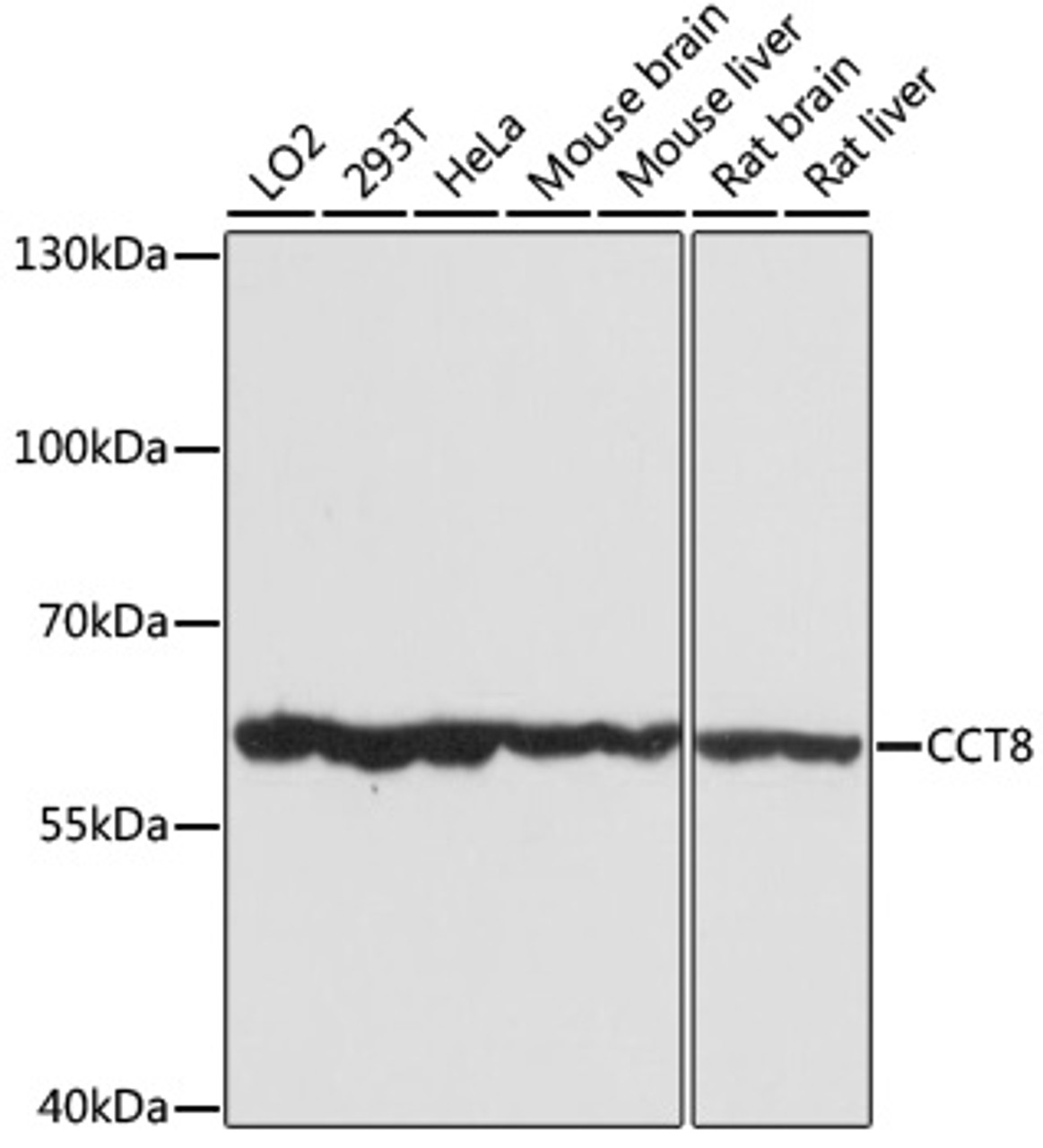 Immunofluorescence analysis of HeLa cells using CCT8 antibody (19-376) at dilution of 1:100 (40x lens) . Blue: DAPI for nuclear staining.