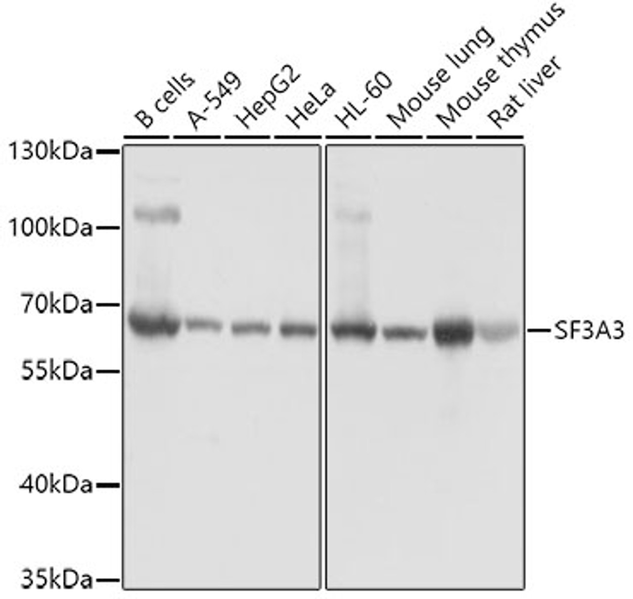 Western blot analysis of extracts of various cell lines, using SF3A3 antibody (19-384) at 1:1000 dilution.<br/>Secondary antibody: HRP Goat Anti-Rabbit IgG (H+L) at 1:10000 dilution.<br/>Lysates/proteins: 25ug per lane.<br/>Blocking buffer: 3% nonfat dry milk in TBST.<br/>Detection: ECL Basic Kit.<br/>Exposure time: 30s.
