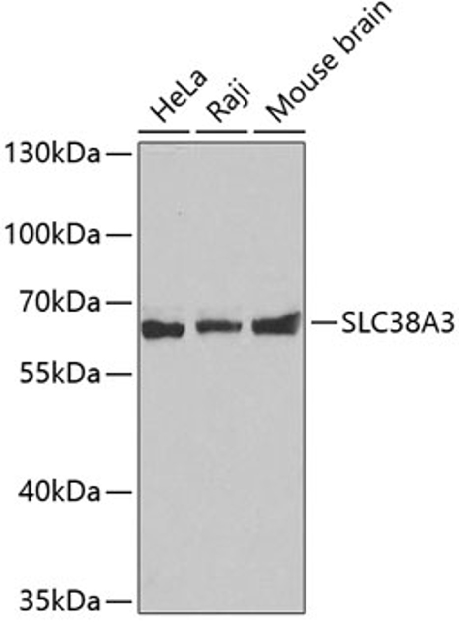 Western blot analysis of extracts of various cell lines, using SLC38A3 antibody (19-389) .<br/>Secondary antibody: HRP Goat Anti-Rabbit IgG (H+L) at 1:10000 dilution.<br/>Lysates/proteins: 25ug per lane.<br/>Blocking buffer: 3% nonfat dry milk in TBST.