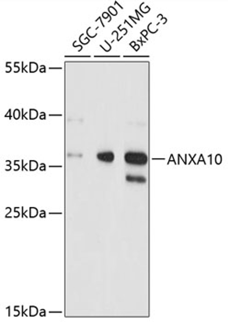 Western blot analysis of extracts of various cell lines, using ANXA10 antibody (19-394) at 1:3000 dilution.<br/>Secondary antibody: HRP Goat Anti-Rabbit IgG (H+L) at 1:10000 dilution.<br/>Lysates/proteins: 25ug per lane.<br/>Blocking buffer: 3% nonfat dry milk in TBST.<br/>Detection: ECL Basic Kit.<br/>Exposure time: 10s.