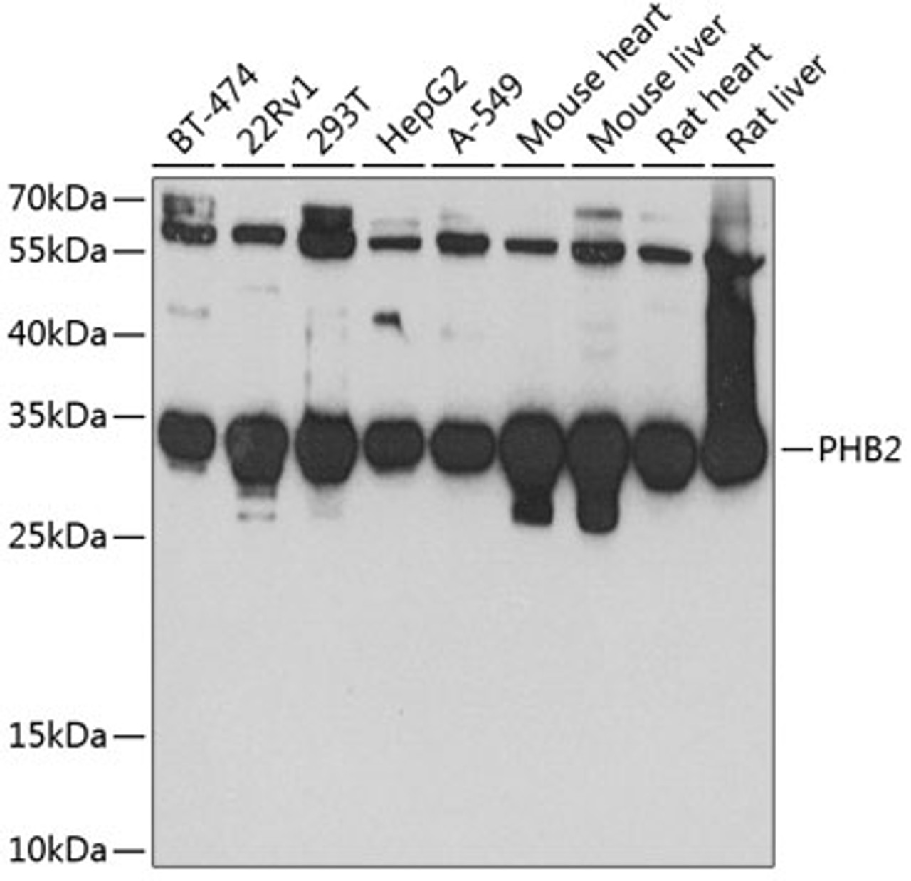 Western blot analysis of extracts of various cell lines, using PHB2 antibody (19-397) at 1:1000 dilution.<br/>Secondary antibody: HRP Goat Anti-Rabbit IgG (H+L) at 1:10000 dilution.<br/>Lysates/proteins: 25ug per lane.<br/>Blocking buffer: 3% nonfat dry milk in TBST.<br/>Detection: ECL Basic Kit.<br/>Exposure time: 90s.