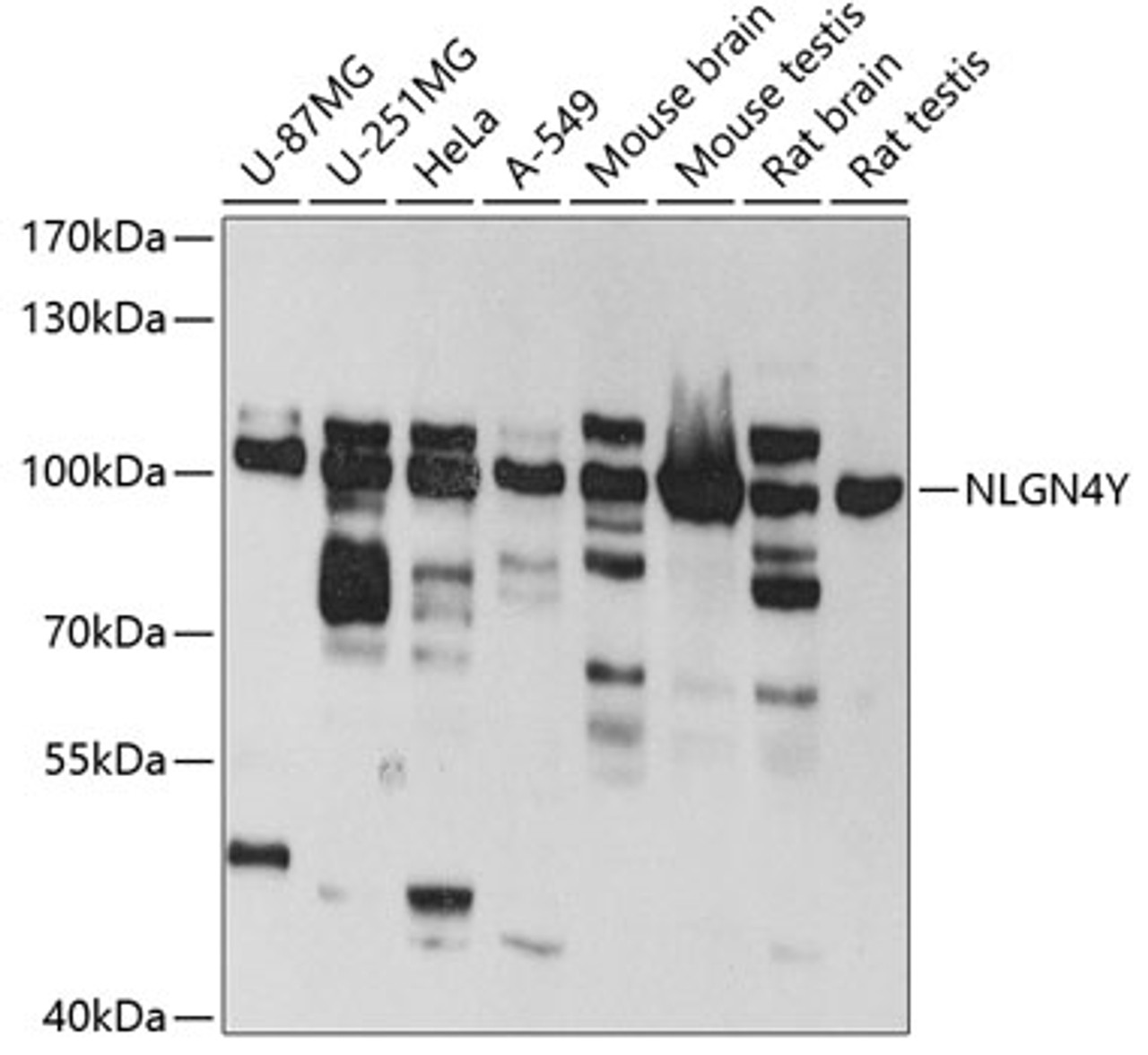 Western blot analysis of extracts of various cell lines, using NLGN4Y antibody (19-401) at 1:1000 dilution.<br/>Secondary antibody: HRP Goat Anti-Rabbit IgG (H+L) at 1:10000 dilution.<br/>Lysates/proteins: 25ug per lane.<br/>Blocking buffer: 3% nonfat dry milk in TBST.<br/>Detection: ECL Basic Kit.<br/>Exposure time: 30s.