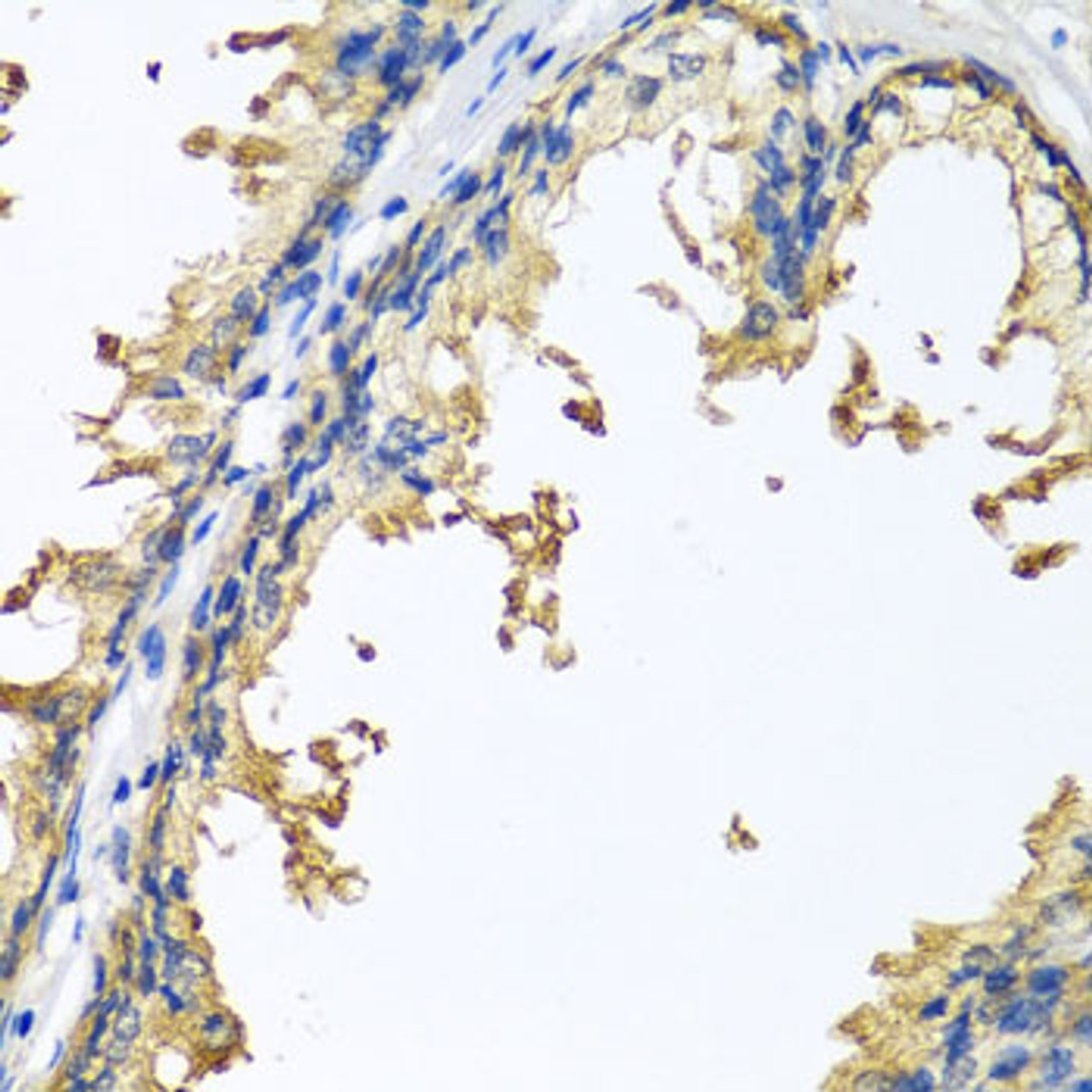 Immunohistochemistry of paraffin-embedded human prostate using NLGN4Y antibody (19-401) at dilution of 1:100 (40x lens) .