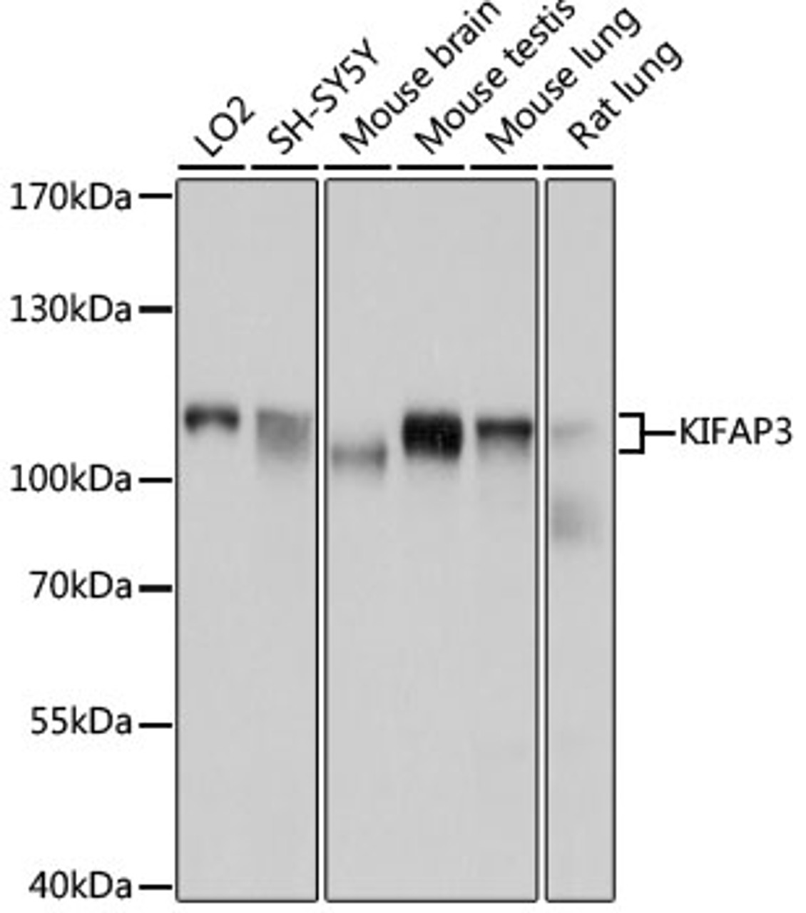 Western blot analysis of extracts of various cell lines, using KIFAP3 antibody (19-403) at 1:1000 dilution.<br/>Secondary antibody: HRP Goat Anti-Rabbit IgG (H+L) at 1:10000 dilution.<br/>Lysates/proteins: 25ug per lane.<br/>Blocking buffer: 3% nonfat dry milk in TBST.<br/>Detection: ECL Basic Kit.<br/>Exposure time: 5s.