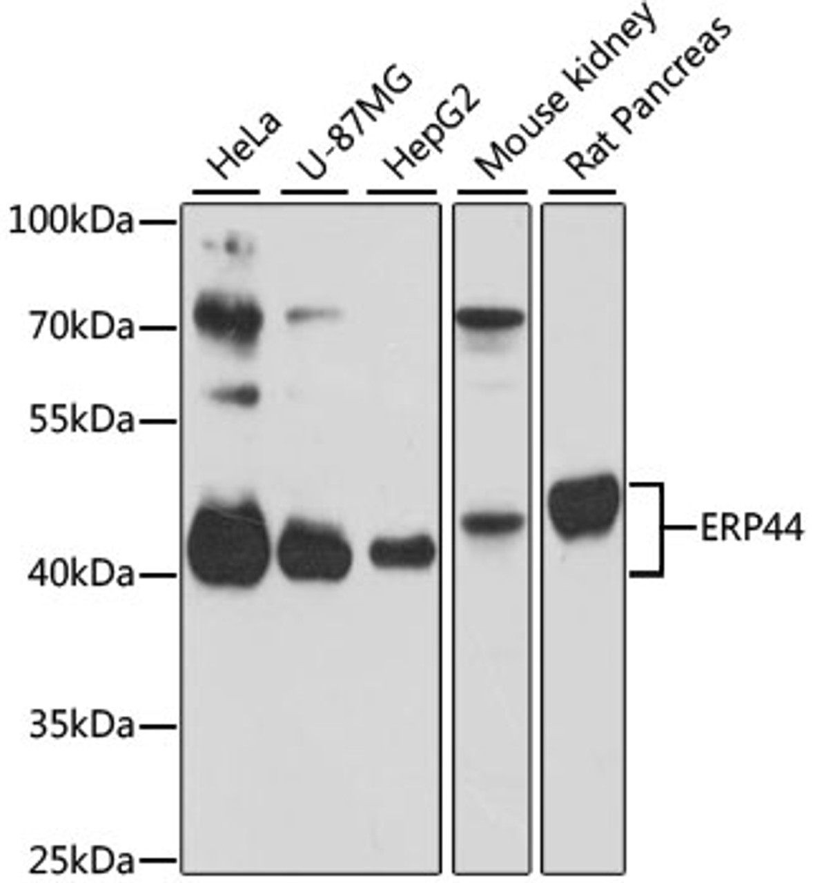 Western blot analysis of extracts of various cell lines, using ERP44 antibody (19-405) at 1:3000 dilution.<br/>Secondary antibody: HRP Goat Anti-Rabbit IgG (H+L) at 1:10000 dilution.<br/>Lysates/proteins: 25ug per lane.<br/>Blocking buffer: 3% nonfat dry milk in TBST.<br/>Detection: ECL Basic Kit.<br/>Exposure time: 30s.