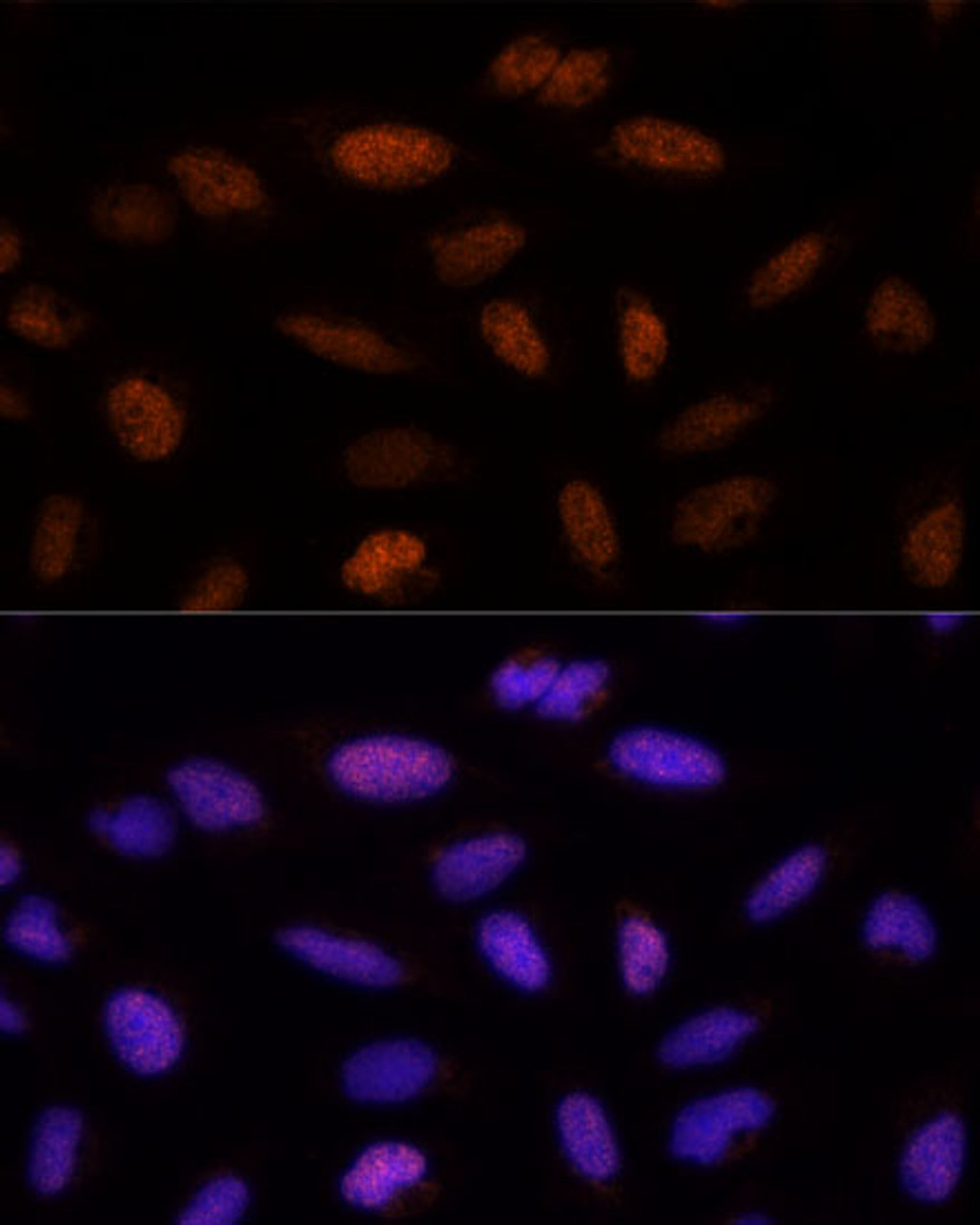 Immunofluorescence analysis of U-2 OS cells using ADNP Polyclonal Antibody (19-410) at dilution of 1:100 (40x lens) . Blue: DAPI for nuclear staining.