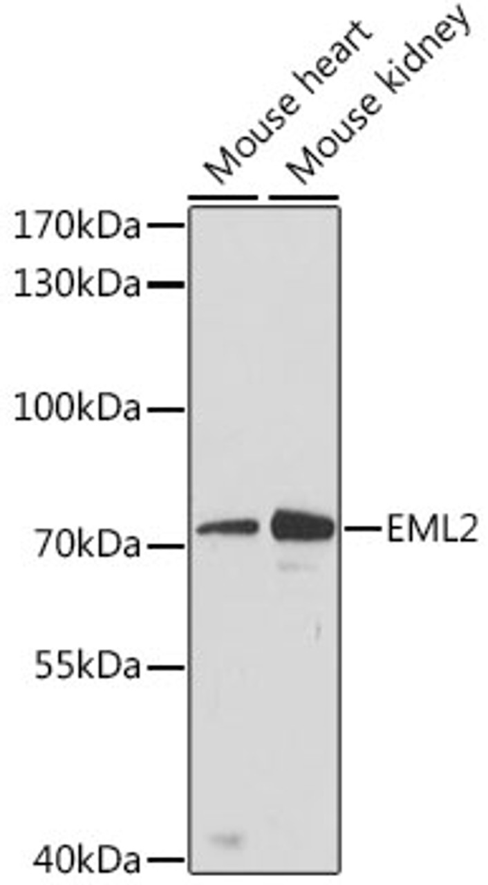 Western blot analysis of extracts of various cell lines, using EML2 antibody (19-417) at 1:3000 dilution.<br/>Secondary antibody: HRP Goat Anti-Rabbit IgG (H+L) at 1:10000 dilution.<br/>Lysates/proteins: 25ug per lane.<br/>Blocking buffer: 3% nonfat dry milk in TBST.<br/>Detection: ECL Basic Kit.<br/>Exposure time: 90s.