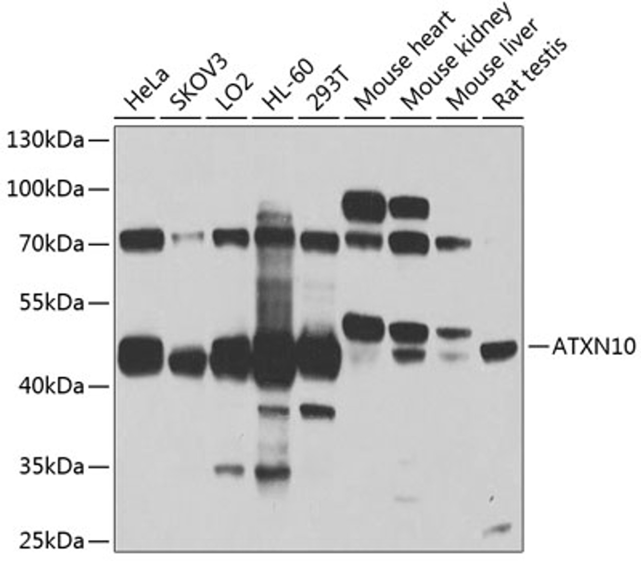 Western blot analysis of extracts of various cell lines, using ATXN10 antibody (19-420) at 1:1000 dilution.<br/>Secondary antibody: HRP Goat Anti-Rabbit IgG (H+L) at 1:10000 dilution.<br/>Lysates/proteins: 25ug per lane.<br/>Blocking buffer: 3% nonfat dry milk in TBST.<br/>Detection: ECL Basic Kit.<br/>Exposure time: 90s.