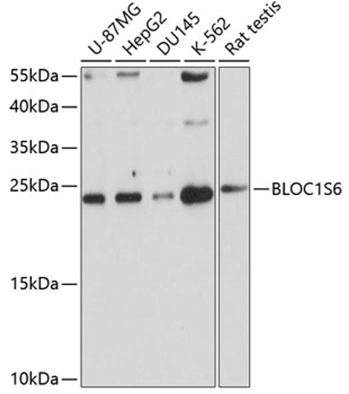 Western blot analysis of extracts of various cell lines, using BLOC1S6 antibody (19-429) at 1:1000 dilution.<br/>Secondary antibody: HRP Goat Anti-Rabbit IgG (H+L) at 1:10000 dilution.<br/>Lysates/proteins: 25ug per lane.<br/>Blocking buffer: 3% nonfat dry milk in TBST.<br/>Detection: ECL Basic Kit.<br/>Exposure time: 30s.