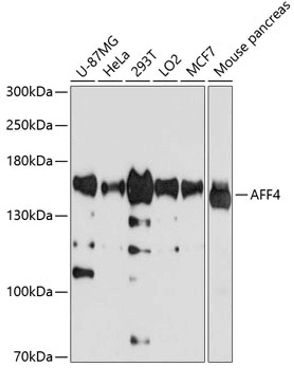 Western blot analysis of extracts of various cell lines, using AFF4 antibody (19-432) at 1:1000 dilution._Secondary antibody: HRP Goat Anti-Rabbit IgG (H+L) at 1:10000 dilution._Lysates/proteins: 25ug per lane._Blocking buffer: 3% nonfat dry milk in TBST._Detection: ECL Basic Kit._Exposure time: 30s.