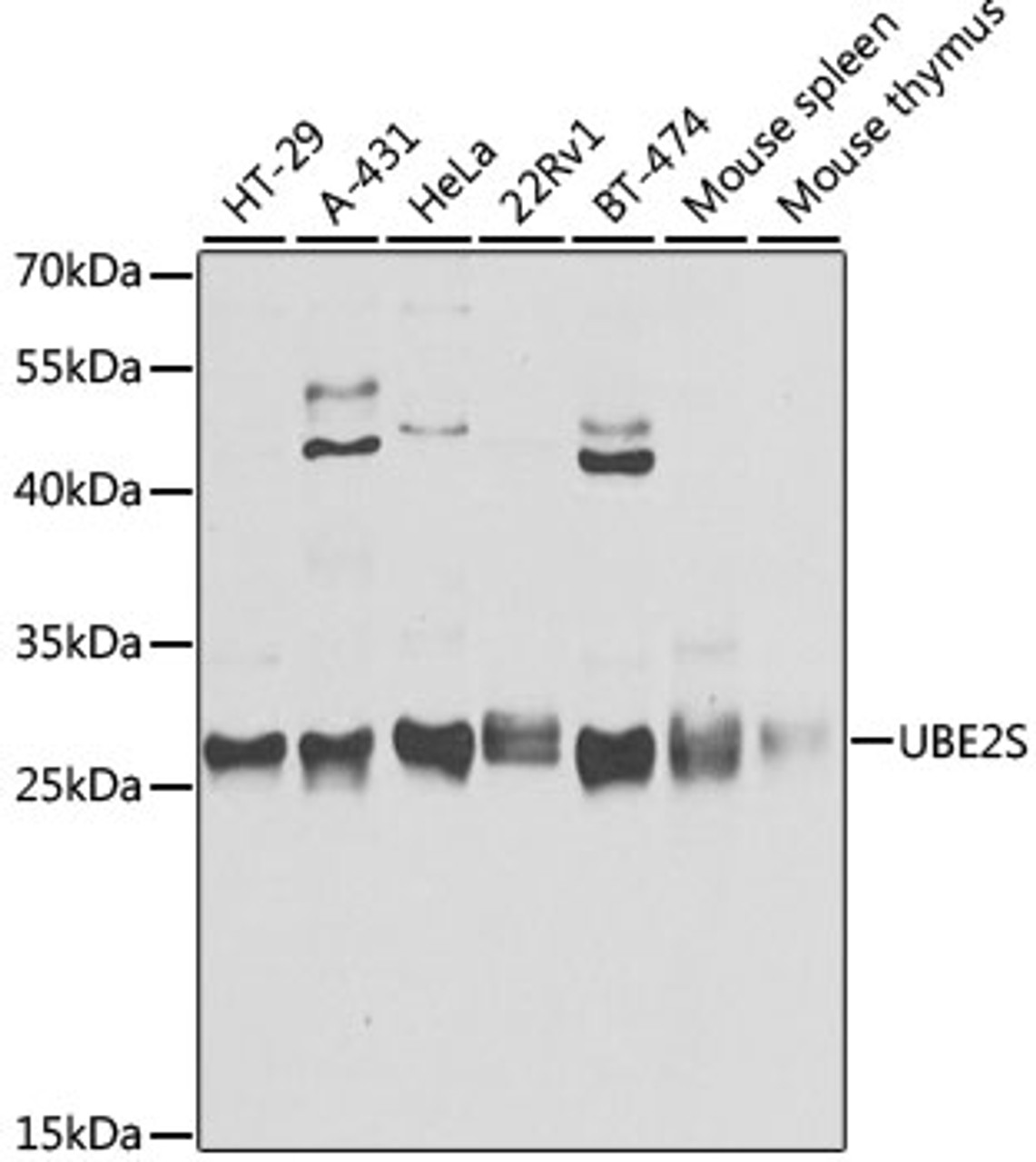 Western blot analysis of extracts of various cell lines, using UBE2S antibody (19-436) at 1:3000 dilution.<br/>Secondary antibody: HRP Goat Anti-Rabbit IgG (H+L) at 1:10000 dilution.<br/>Lysates/proteins: 25ug per lane.<br/>Blocking buffer: 3% nonfat dry milk in TBST.<br/>Detection: ECL Basic Kit.<br/>Exposure time: 10s.