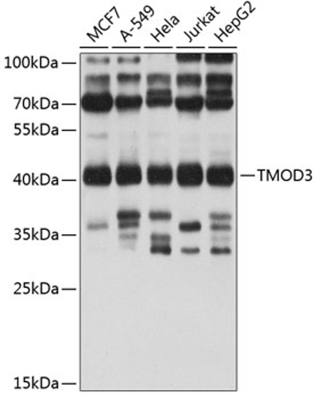 Western blot analysis of extracts of various cell lines, using TMOD3 antibody (19-441) at 1:1000 dilution.<br/>Secondary antibody: HRP Goat Anti-Rabbit IgG (H+L) at 1:10000 dilution.<br/>Lysates/proteins: 25ug per lane.<br/>Blocking buffer: 3% nonfat dry milk in TBST.<br/>Detection: ECL Basic Kit.<br/>Exposure time: 20s.