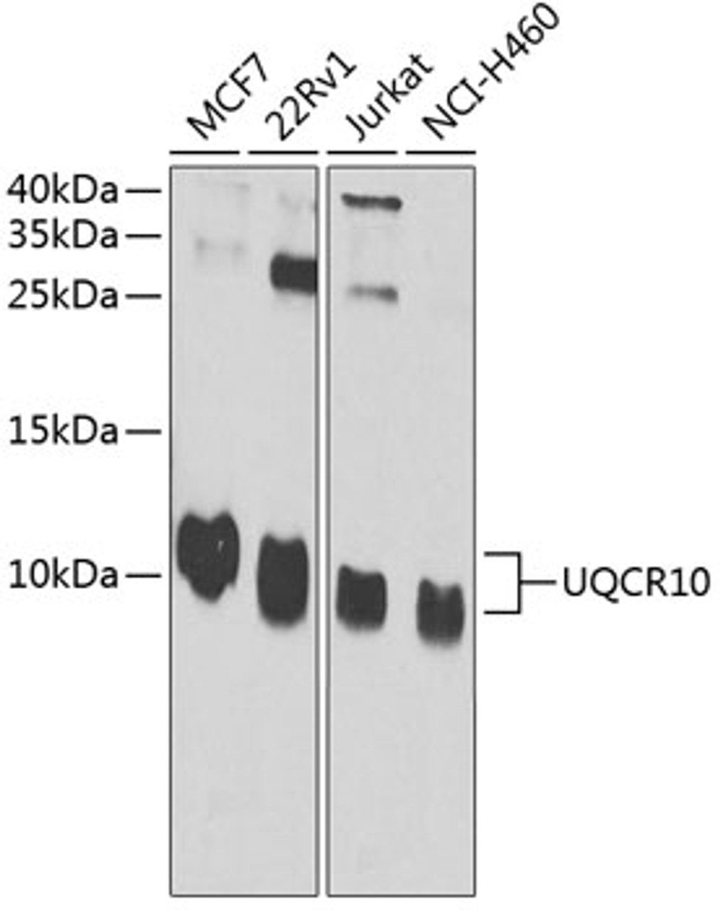 Western blot analysis of extracts of various cell lines, using UQCR10 antibody (19-442) at 1:1000 dilution.<br/>Secondary antibody: HRP Goat Anti-Rabbit IgG (H+L) at 1:10000 dilution.<br/>Lysates/proteins: 25ug per lane.<br/>Blocking buffer: 3% nonfat dry milk in TBST.<br/>Detection: ECL Enhanced Kit.<br/>Exposure time: 30s.