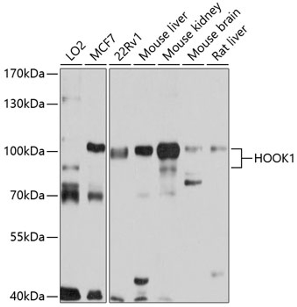 Western blot analysis of extracts of various cell lines, using HOOK1 antibody (19-454) at 1:1000 dilution.<br/>Secondary antibody: HRP Goat Anti-Rabbit IgG (H+L) at 1:10000 dilution.<br/>Lysates/proteins: 25ug per lane.<br/>Blocking buffer: 3% nonfat dry milk in TBST.<br/>Detection: ECL Basic Kit.<br/>Exposure time: 5s.