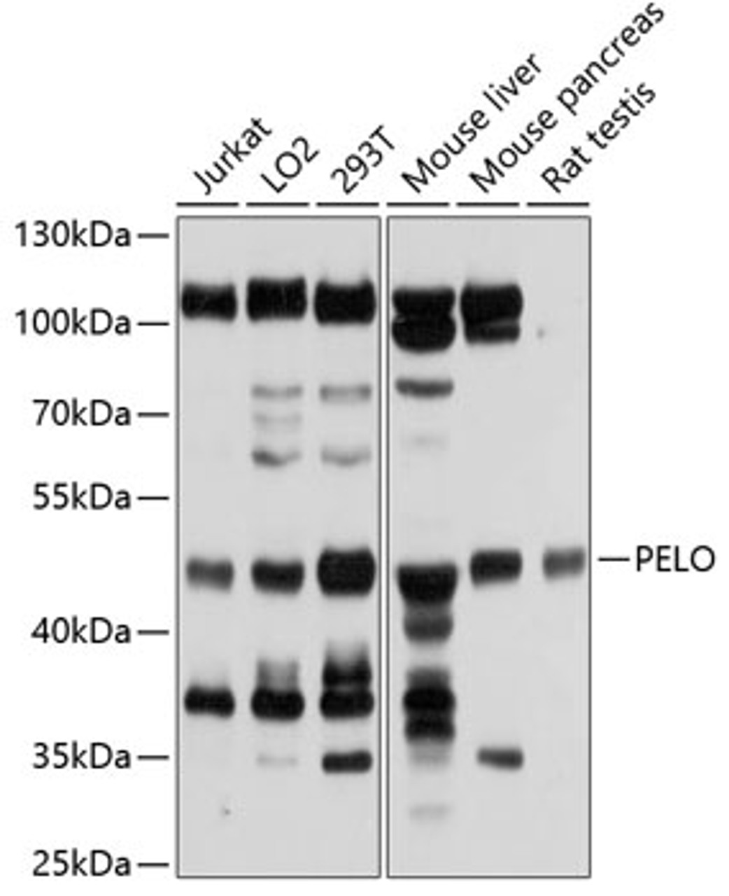 Western blot analysis of extracts of various cell lines, using PELO antibody (19-465) at 1:1000 dilution.<br/>Secondary antibody: HRP Goat Anti-Rabbit IgG (H+L) at 1:10000 dilution.<br/>Lysates/proteins: 25ug per lane.<br/>Blocking buffer: 3% nonfat dry milk in TBST.<br/>Detection: ECL Basic Kit.<br/>Exposure time: 5s.