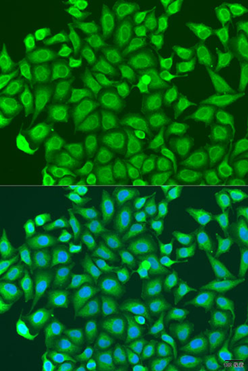 Immunofluorescence analysis of U2OS cells using PCDHA6 antibody (19-489) at dilution of 1:100. Blue: DAPI for nuclear staining.