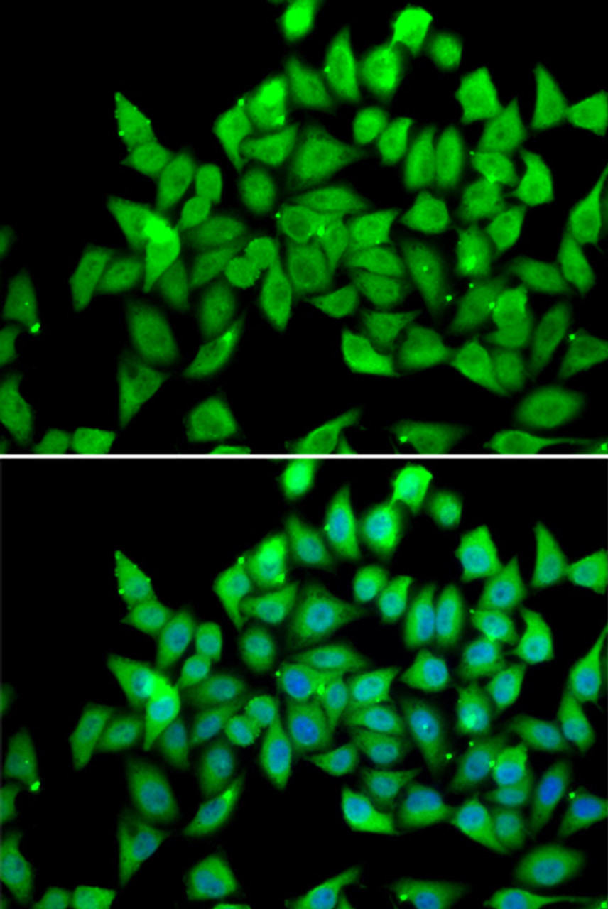 Immunofluorescence analysis of A549 cells using ALS2 antibody (19-493) . Blue: DAPI for nuclear staining.