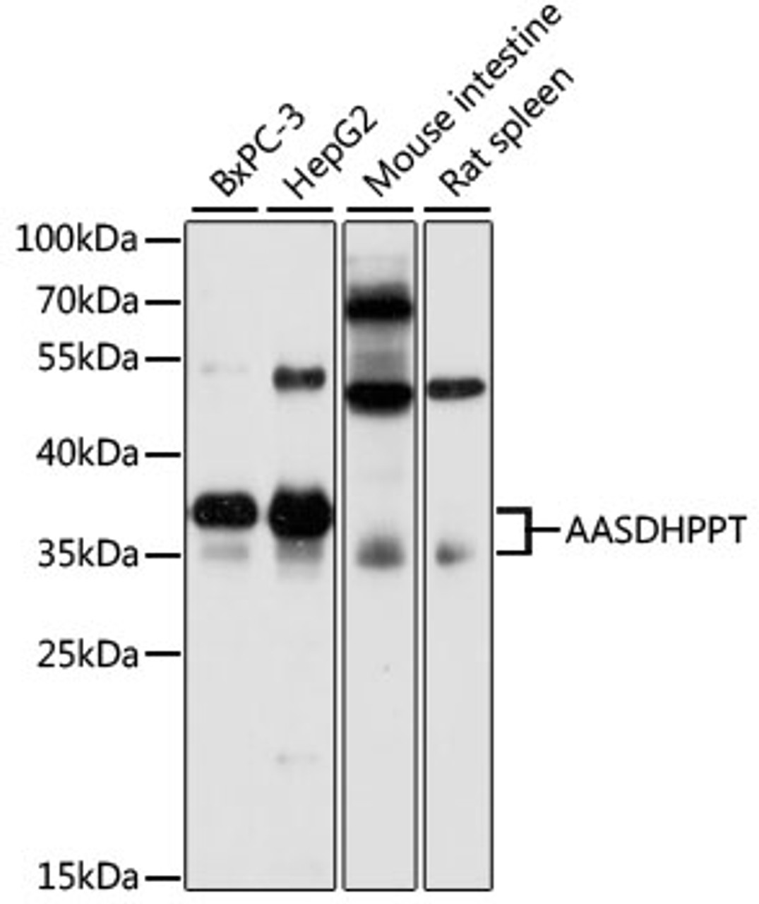 Western blot analysis of extracts of various cell lines, using AASDHPPT antibody (19-496) at 1:3000 dilution.<br/>Secondary antibody: HRP Goat Anti-Rabbit IgG (H+L) at 1:10000 dilution.<br/>Lysates/proteins: 25ug per lane.<br/>Blocking buffer: 3% nonfat dry milk in TBST.<br/>Detection: ECL Basic Kit.<br/>Exposure time: 30s.