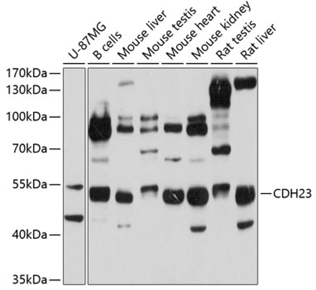 Western blot analysis of extracts of various cell lines, using CDH23 antibody (19-497) at 1:1000 dilution.<br/>Secondary antibody: HRP Goat Anti-Rabbit IgG (H+L) at 1:10000 dilution.<br/>Lysates/proteins: 25ug per lane.<br/>Blocking buffer: 3% nonfat dry milk in TBST.<br/>Detection: ECL Basic Kit.<br/>Exposure time: 10s.