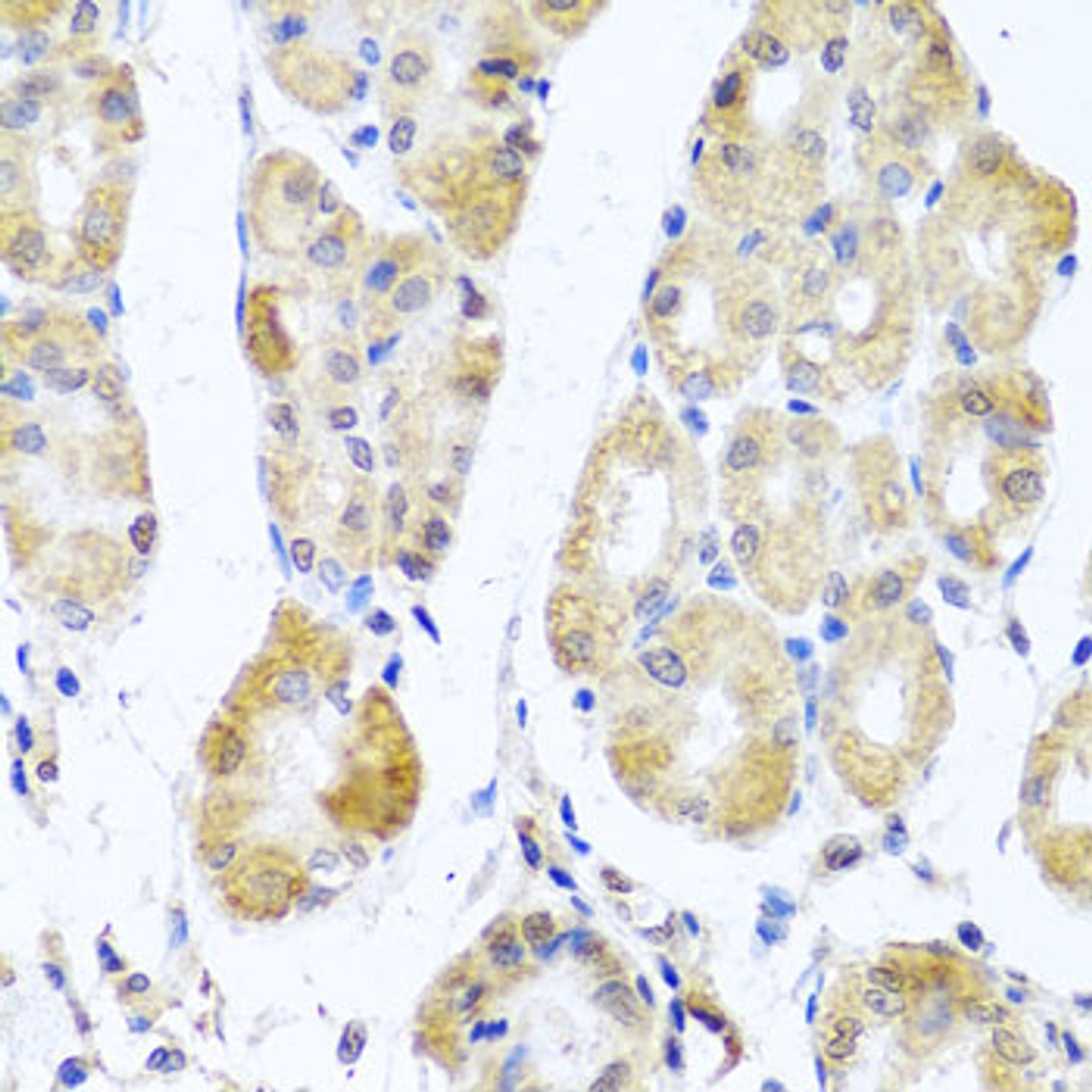 Immunohistochemistry of paraffin-embedded human stomach using MRPL11 antibody (19-504) at dilution of 1:100 (40x lens) .