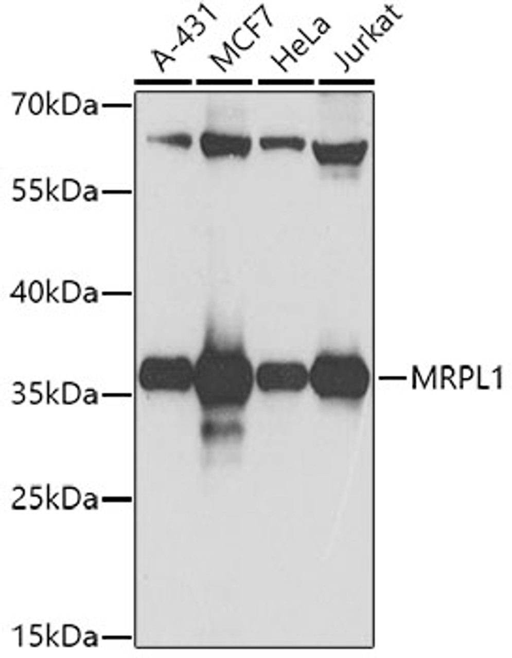 Western blot analysis of extracts of various cell lines, using MRPL1 antibody (19-505) at 1:1000 dilution.<br/>Secondary antibody: HRP Goat Anti-Rabbit IgG (H+L) at 1:10000 dilution.<br/>Lysates/proteins: 25ug per lane.<br/>Blocking buffer: 3% nonfat dry milk in TBST.<br/>Detection: ECL Basic Kit.<br/>Exposure time: 10s.