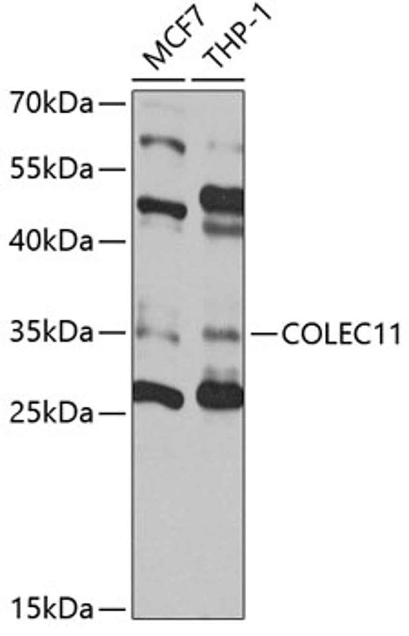 Western blot analysis of extracts of various cell lines, using COLEC11 antibody (19-507) at 1:1000 dilution.<br/>Secondary antibody: HRP Goat Anti-Rabbit IgG (H+L) at 1:10000 dilution.<br/>Lysates/proteins: 25ug per lane.<br/>Blocking buffer: 3% nonfat dry milk in TBST.<br/>Detection: ECL Enhanced Kit.<br/>Exposure time: 60s.