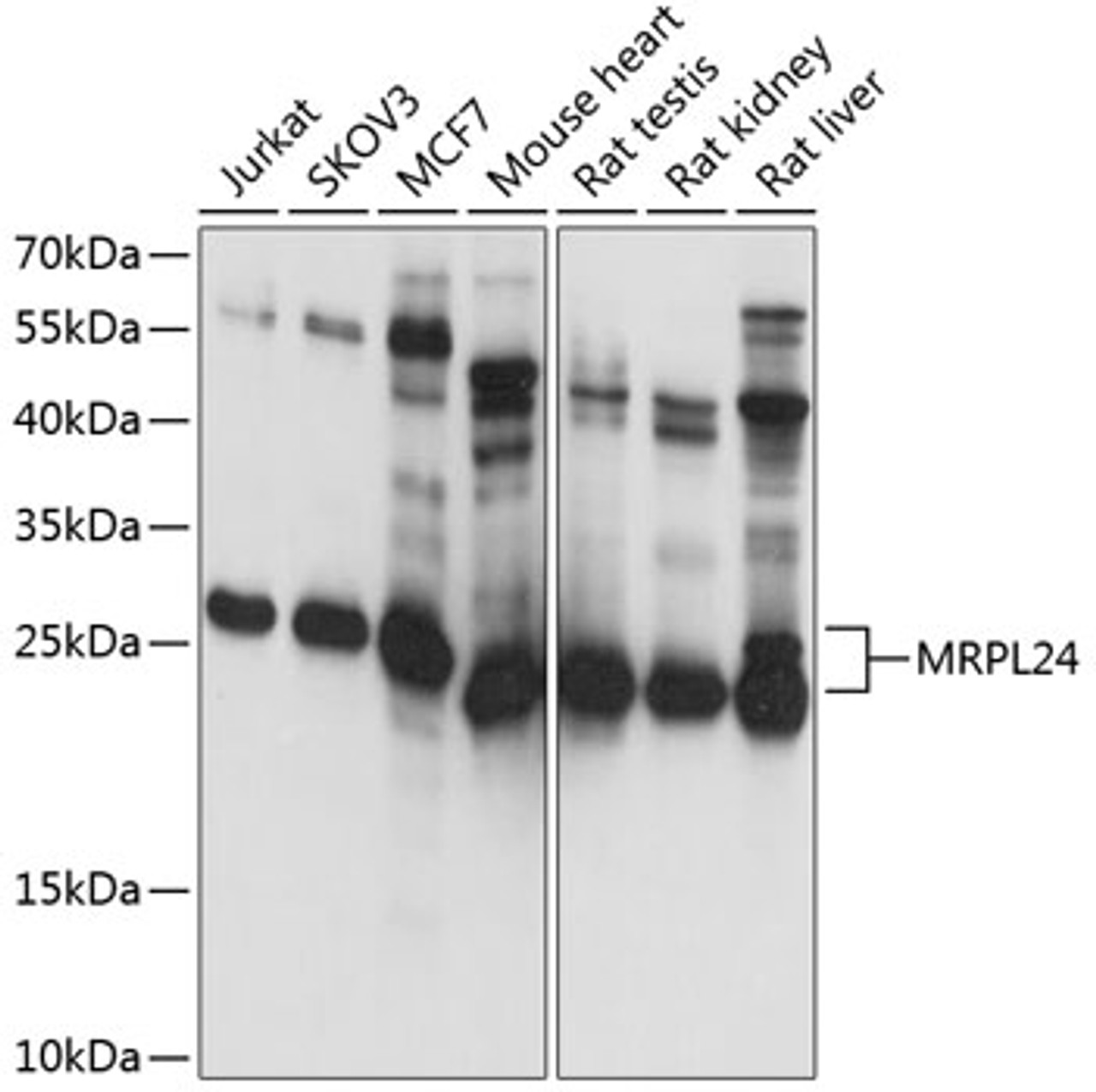 Western blot analysis of extracts of various cell lines, using MRPL24 antibody (19-511) at 1:1000 dilution.<br/>Secondary antibody: HRP Goat Anti-Rabbit IgG (H+L) at 1:10000 dilution.<br/>Lysates/proteins: 25ug per lane.<br/>Blocking buffer: 3% nonfat dry milk in TBST.<br/>Detection: ECL Basic Kit.<br/>Exposure time: 1s.