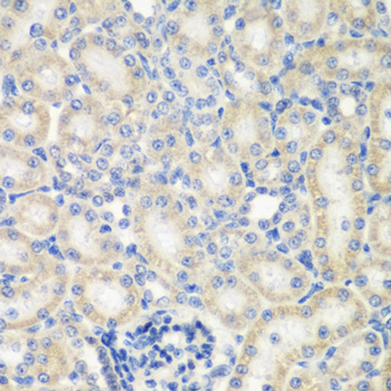 Immunohistochemistry of paraffin-embedded rat kidney using NAA50 antibody (19-519) at dilution of 1:200 (40x lens) .