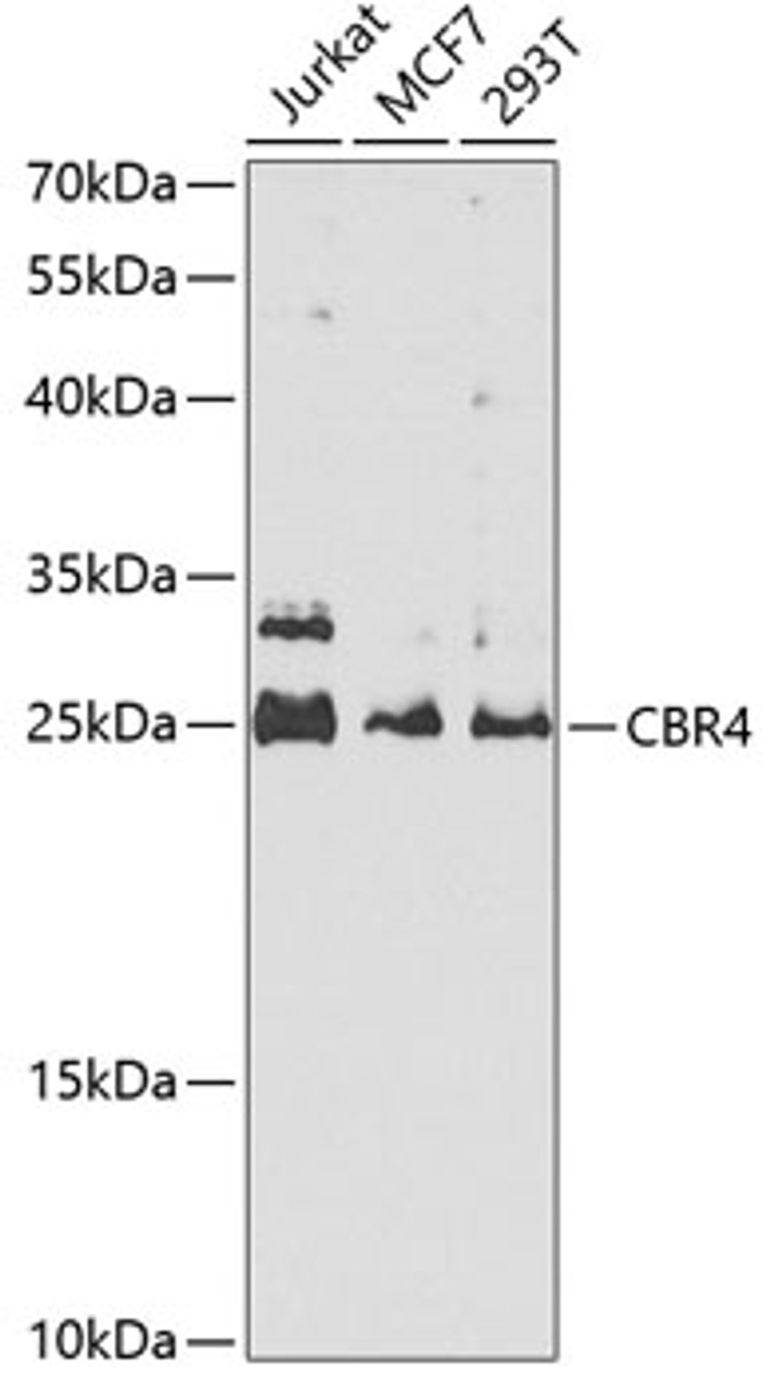 Western blot analysis of extracts of various cell lines, using CBR4 antibody (19-529) at 1:1000 dilution._Secondary antibody: HRP Goat Anti-Rabbit IgG (H+L) at 1:10000 dilution._Lysates/proteins: 25ug per lane._Blocking buffer: 3% nonfat dry milk in TBST._Detection: ECL Enhanced Kit._Exposure time: 90s.