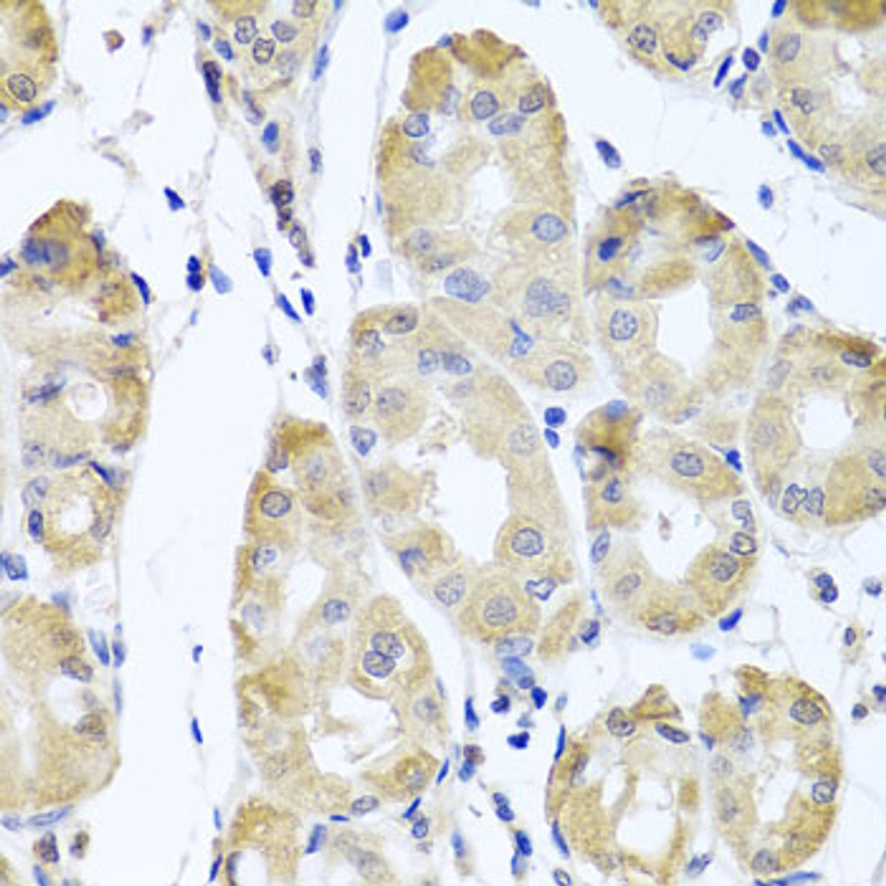 Immunohistochemistry of paraffin-embedded human stomach using CBR4 antibody (19-529) at dilution of 1:100 (40x lens) .
