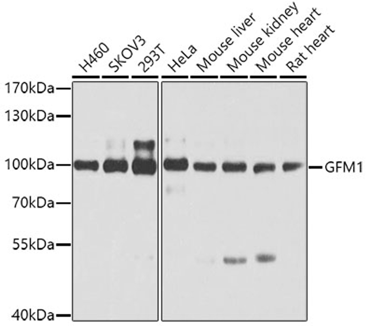 Western blot analysis of extracts of various cell lines, using GFM1 antibody (19-530) at 1:3000 dilution.<br/>Secondary antibody: HRP Goat Anti-Rabbit IgG (H+L) at 1:10000 dilution.<br/>Lysates/proteins: 25ug per lane.<br/>Blocking buffer: 3% nonfat dry milk in TBST.<br/>Detection: ECL Enhanced Kit.<br/>Exposure time: 1s.