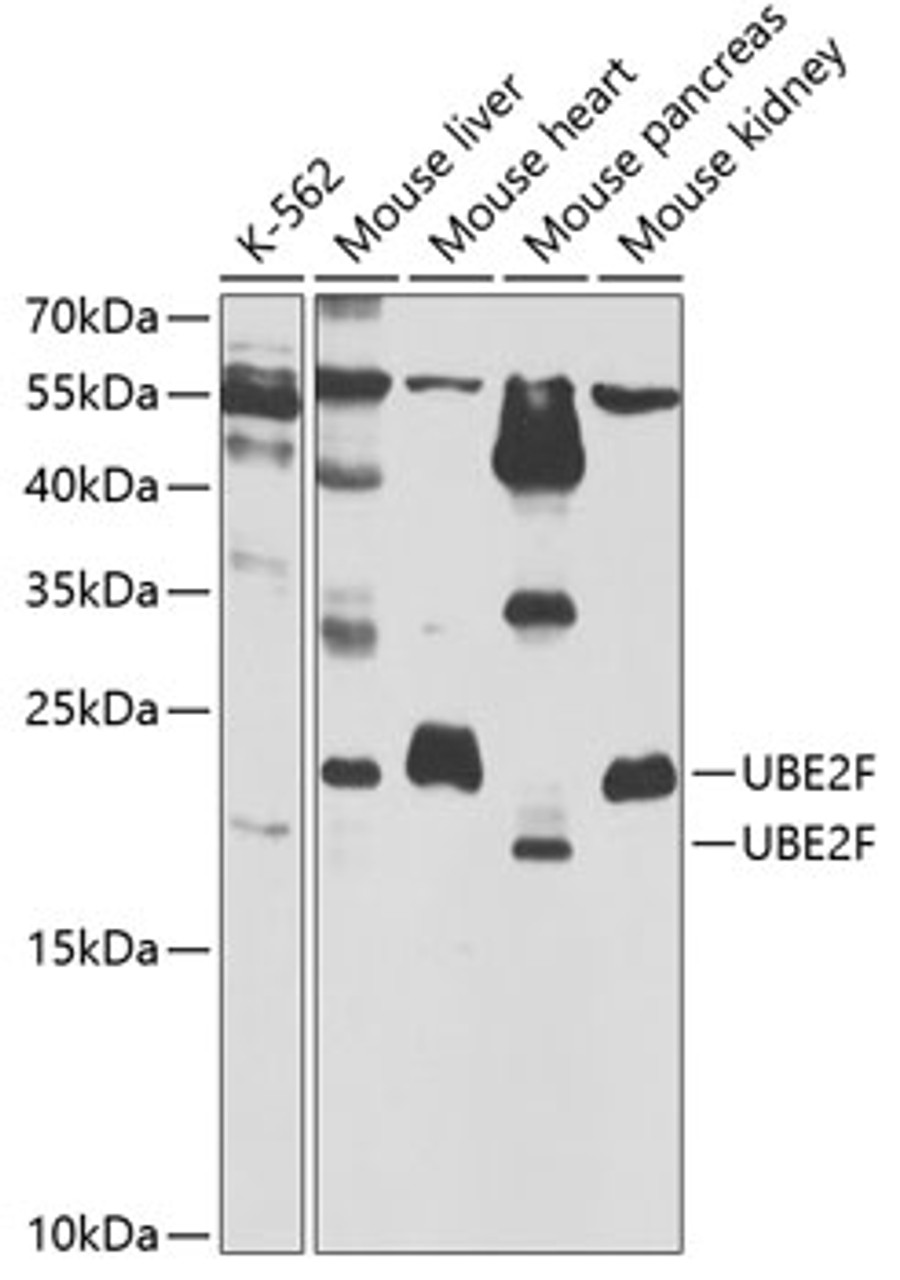 Western blot analysis of extracts of various cell lines, using UBE2F antibody (19-539) at 1:1000 dilution.<br/>Secondary antibody: HRP Goat Anti-Rabbit IgG (H+L) at 1:10000 dilution.<br/>Lysates/proteins: 25ug per lane.<br/>Blocking buffer: 3% nonfat dry milk in TBST.<br/>Detection: ECL Basic Kit.<br/>Exposure time: 90s.