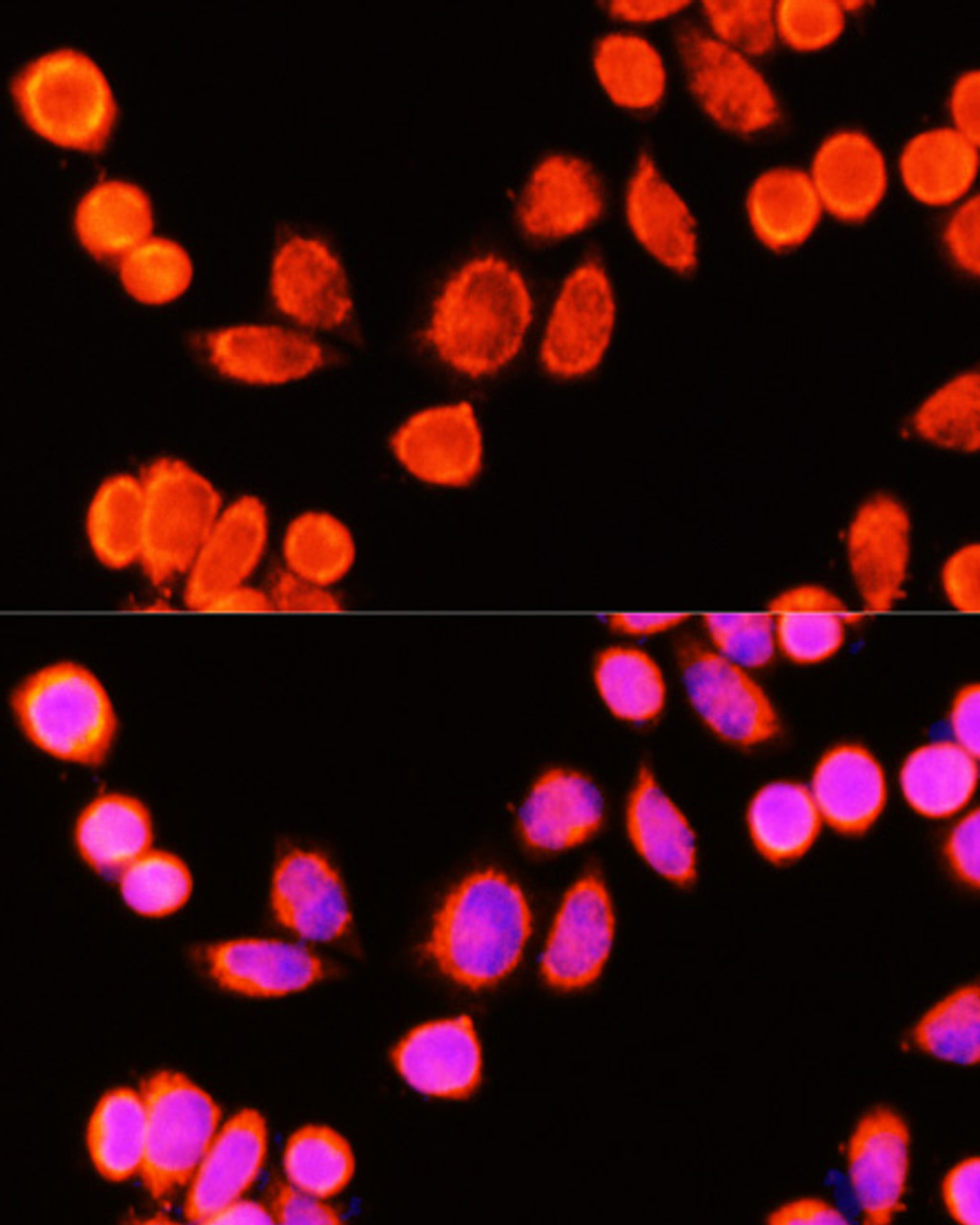 Immunofluorescence analysis of Hela cells using GSTK1 antibody (19-545) at dilution of 1:100 (40x lens) . Blue: DAPI for nuclear staining.