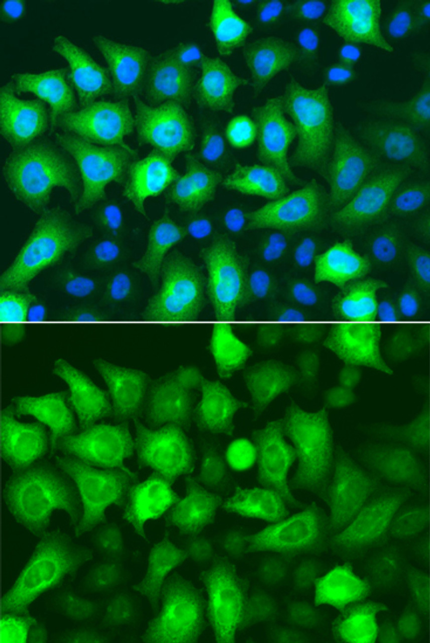 Immunofluorescence analysis of A549 cells using RRM2 antibody (19-553) . Blue: DAPI for nuclear staining.