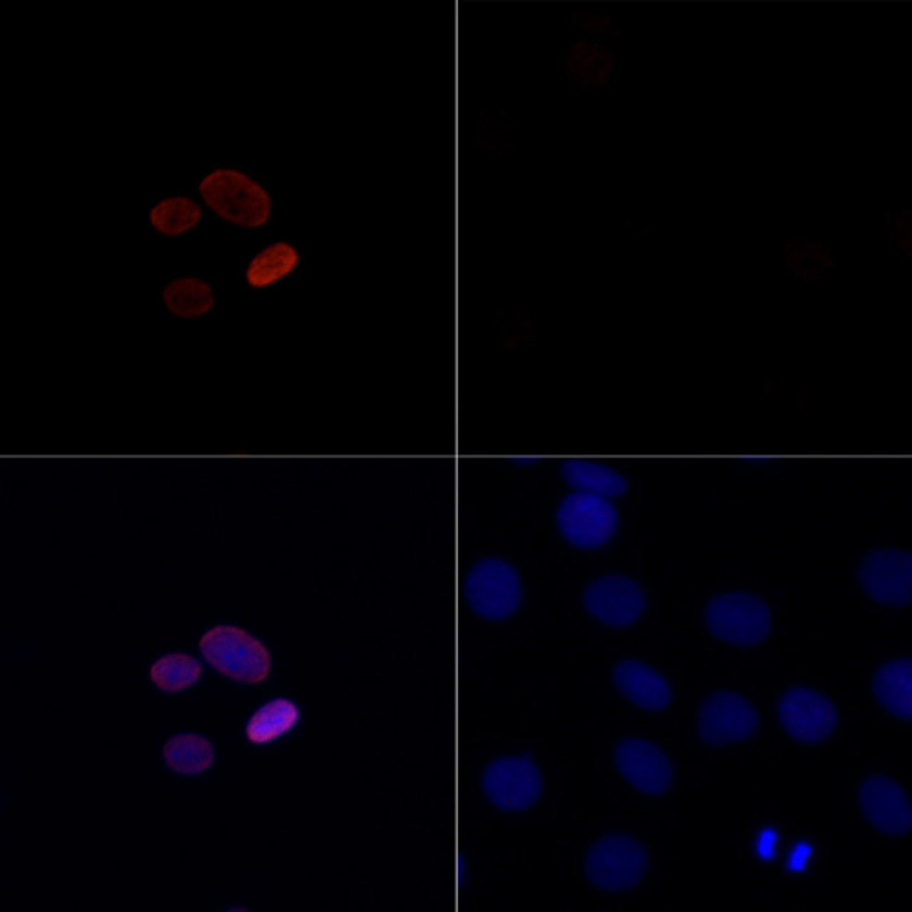 Immunofluorescence analysis of C6 cells treated by TSA (upper left) and untreated C6 cells (upper right) using Acetyl-Histone H4-K16 Rabbit pAb (red, 19-561) at dilution of 1:100. Blue: DAPI for nuclear staining.