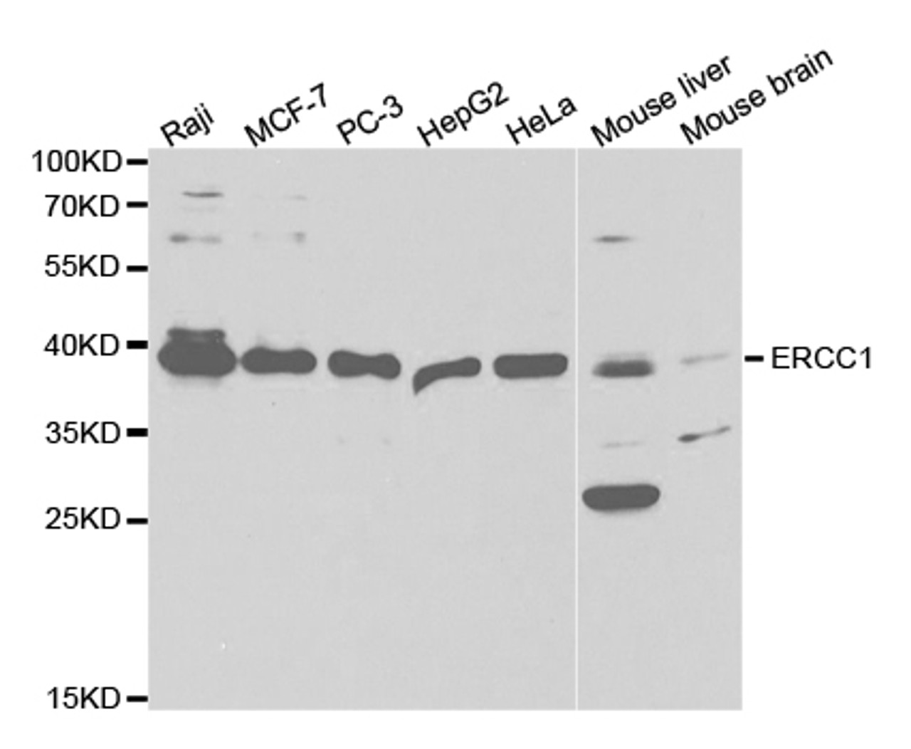 Western blot analysis of extracts of various cell lines, using ERCC1 antibody (19-564) at 1:1000 dilution.<br/>Secondary antibody: HRP Goat Anti-Rabbit IgG (H+L) at 1:10000 dilution.<br/>Lysates/proteins: 25ug per lane.<br/>Blocking buffer: 3% nonfat dry milk in TBST.<br/>Detection: ECL Basic Kit.<br/>Exposure time: 90s.