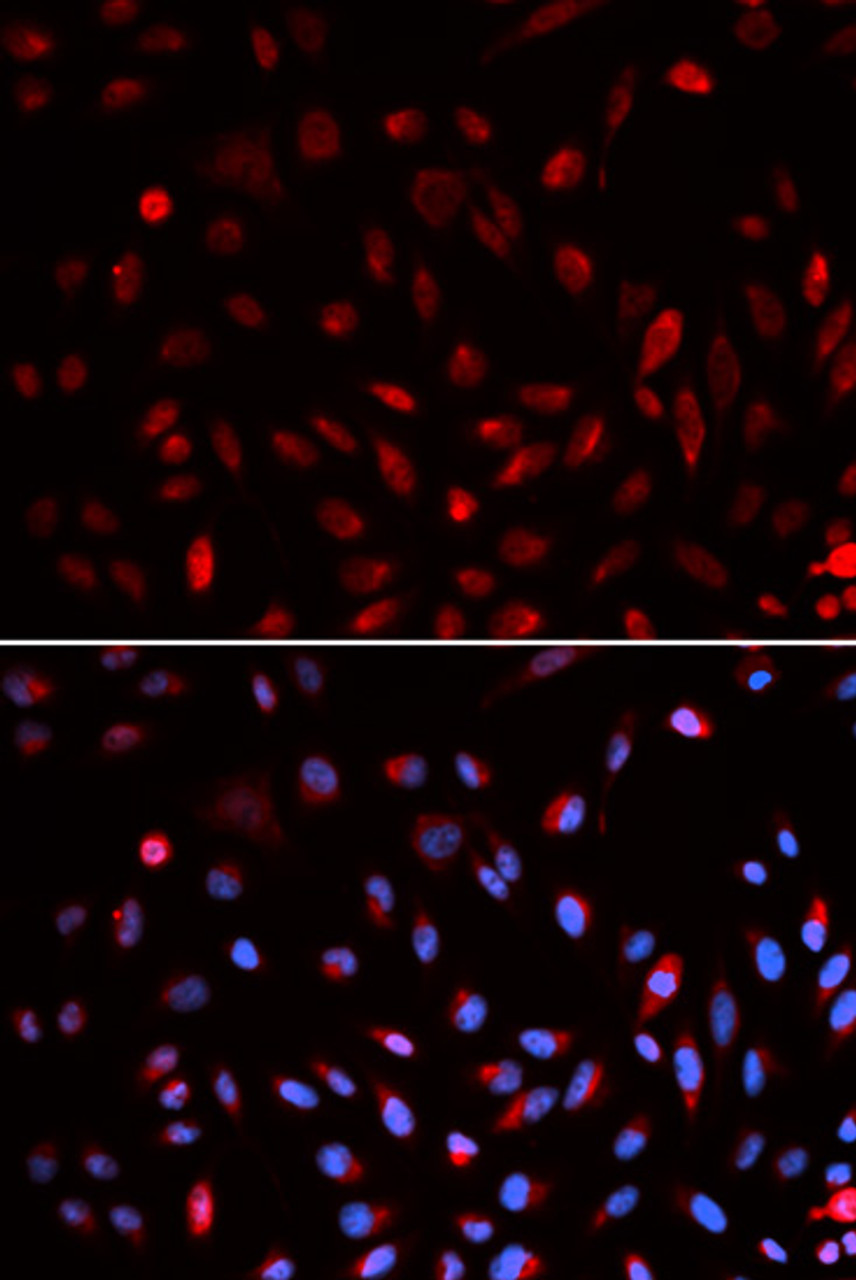 Immunofluorescence analysis of U2OS cells using ERCC1 antibody (19-564) . Blue: DAPI for nuclear staining.