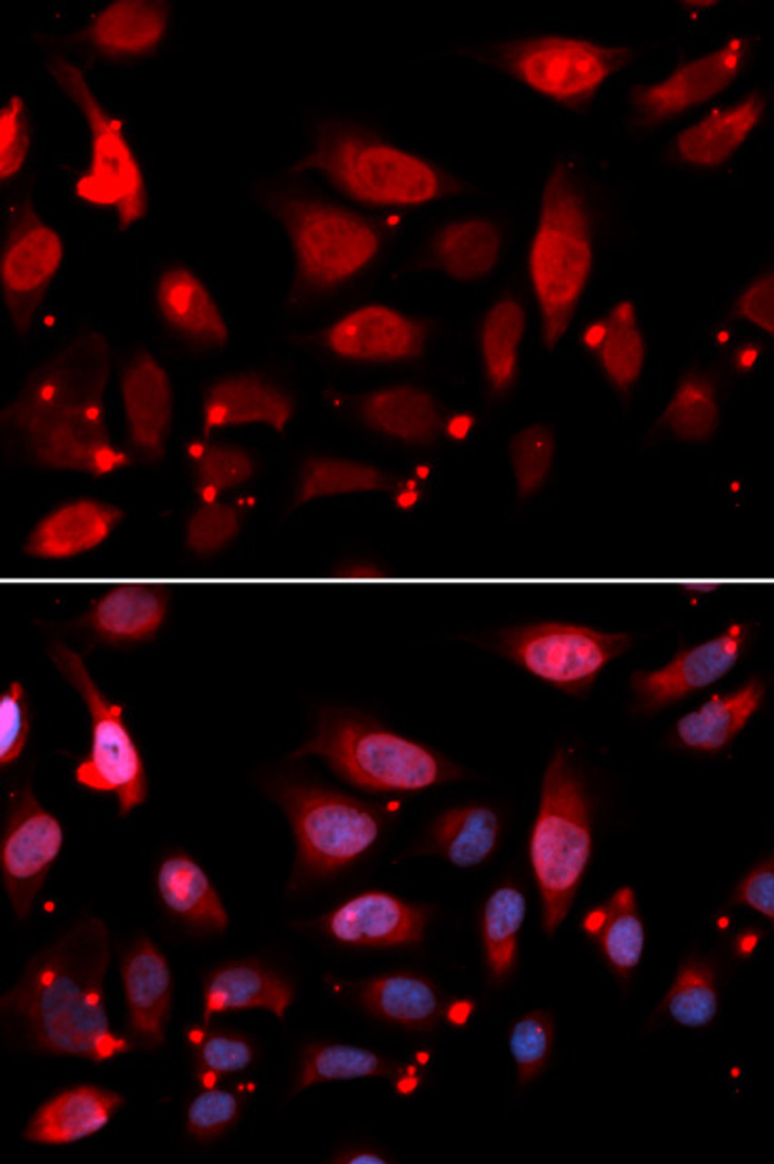 Immunofluorescence analysis of U2OS cells using RACGAP1 antibody (19-569) . Blue: DAPI for nuclear staining.