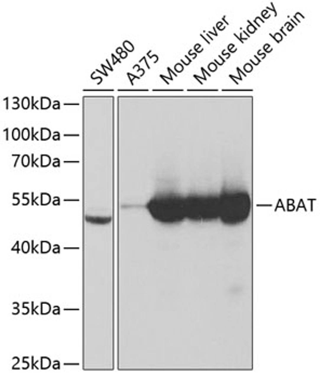 Western blot analysis of extracts of various cell lines, using ABAT antibody (19-570) at 1:1000 dilution.<br/>Secondary antibody: HRP Goat Anti-Rabbit IgG (H+L) at 1:10000 dilution.<br/>Lysates/proteins: 25ug per lane.<br/>Blocking buffer: 3% nonfat dry milk in TBST.<br/>Detection: ECL Basic Kit.<br/>Exposure time: 10s.