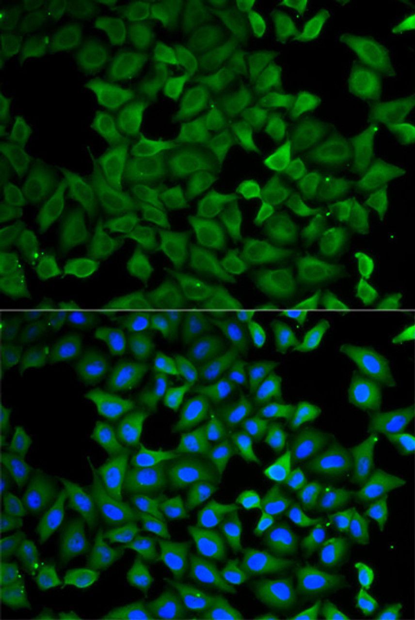 Immunofluorescence analysis of A549 cells using ATL1 antibody (19-571) . Blue: DAPI for nuclear staining.